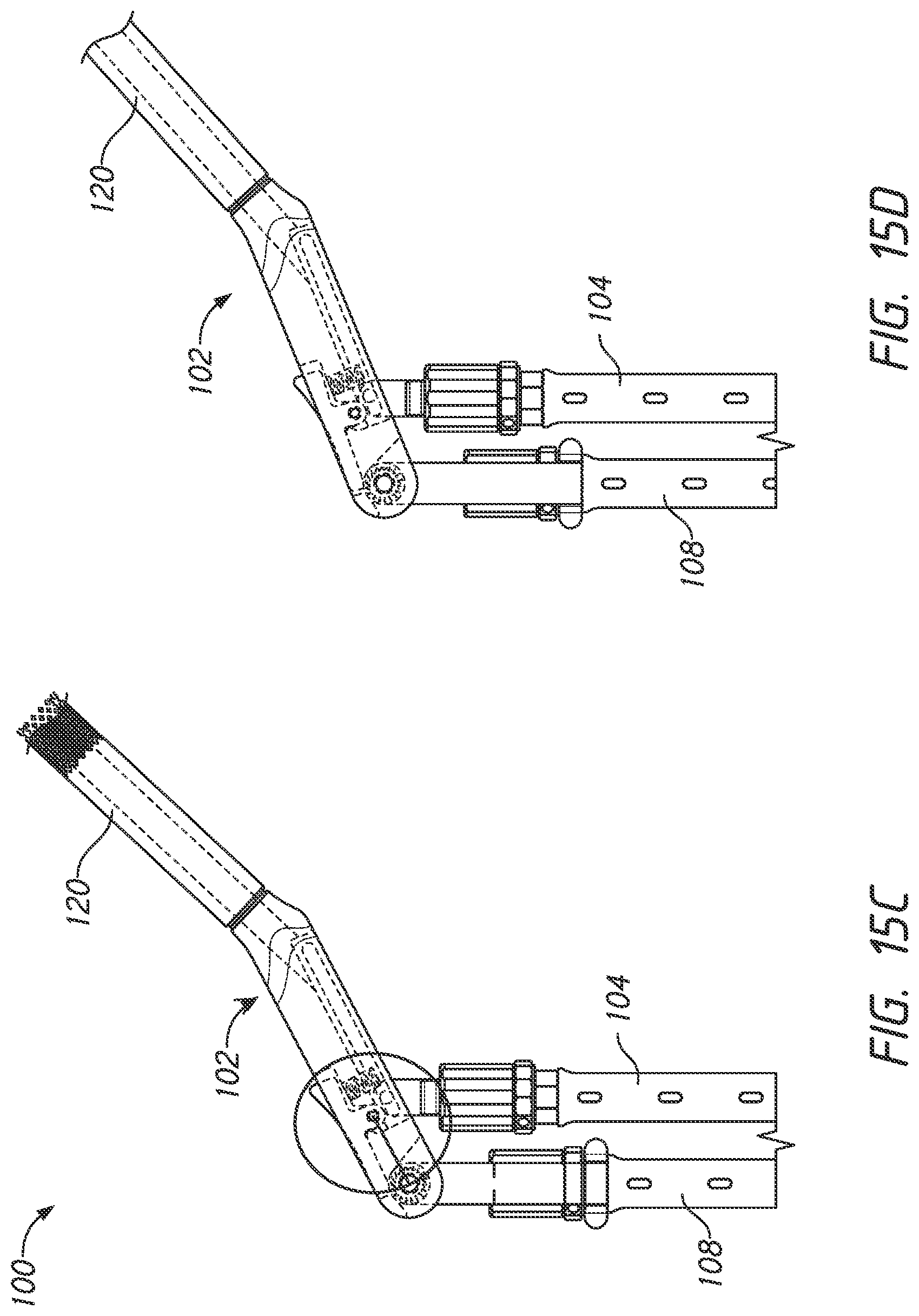 Patent US12324610 Figure 16 – Lever reducer