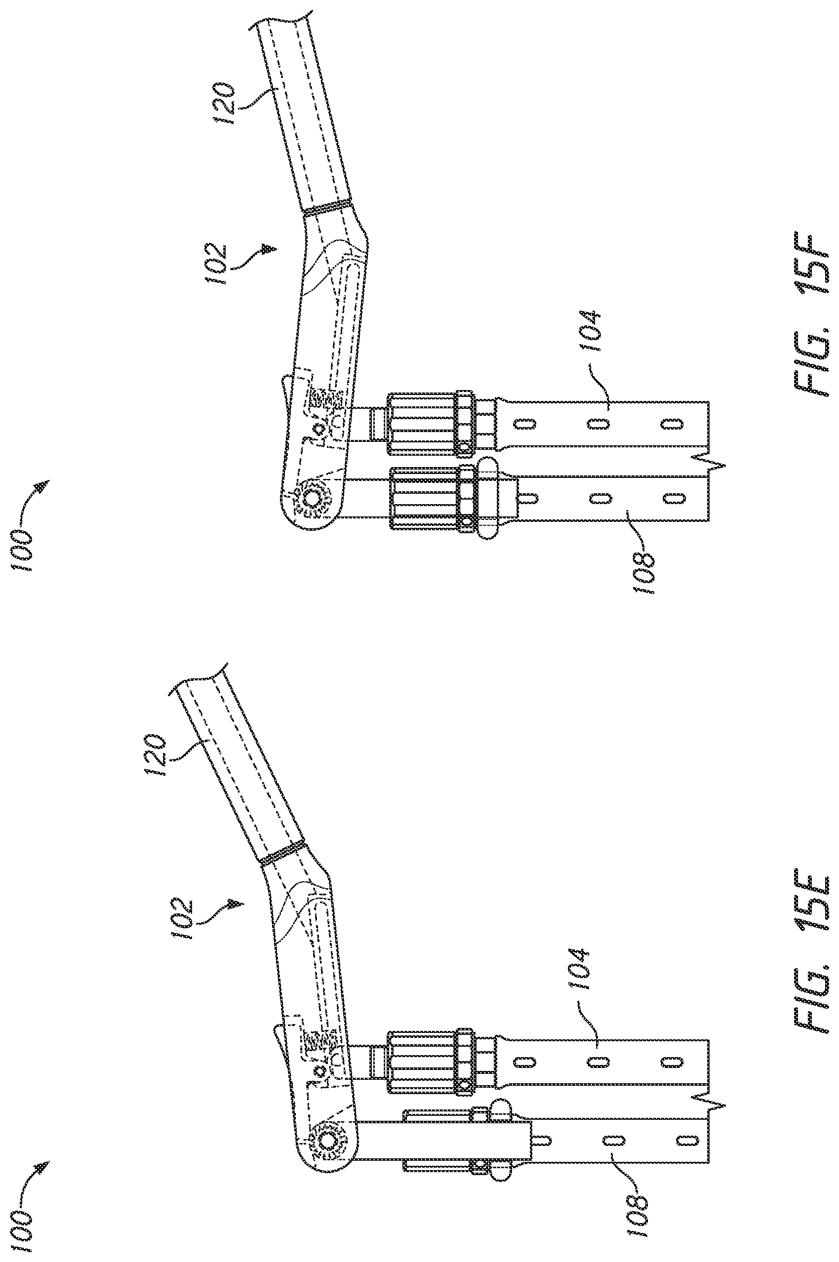 Patent US12324610 Figure 17 – Lever reducer