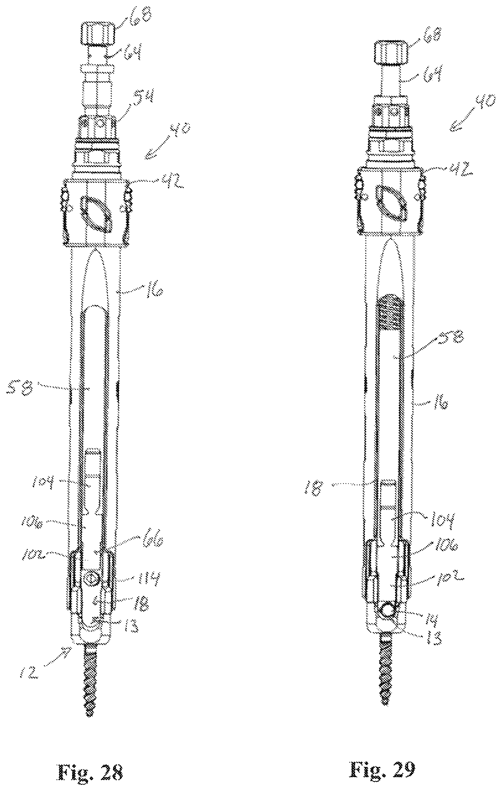 Patent US12324611 Figure 11 – Spinal fixation system