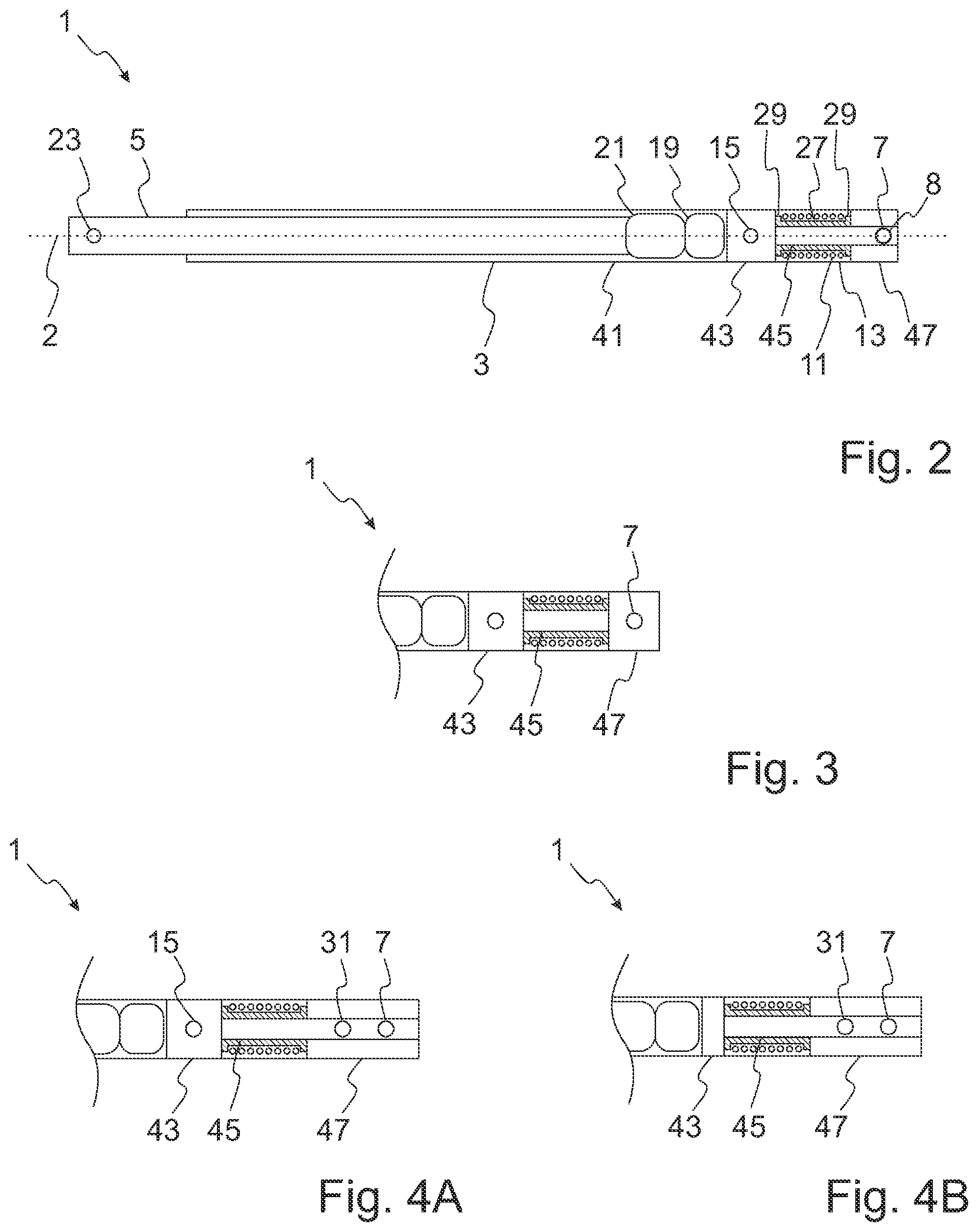 Patent US12324612 Figure 2 – Intramedullary nail for distracting a long bone
