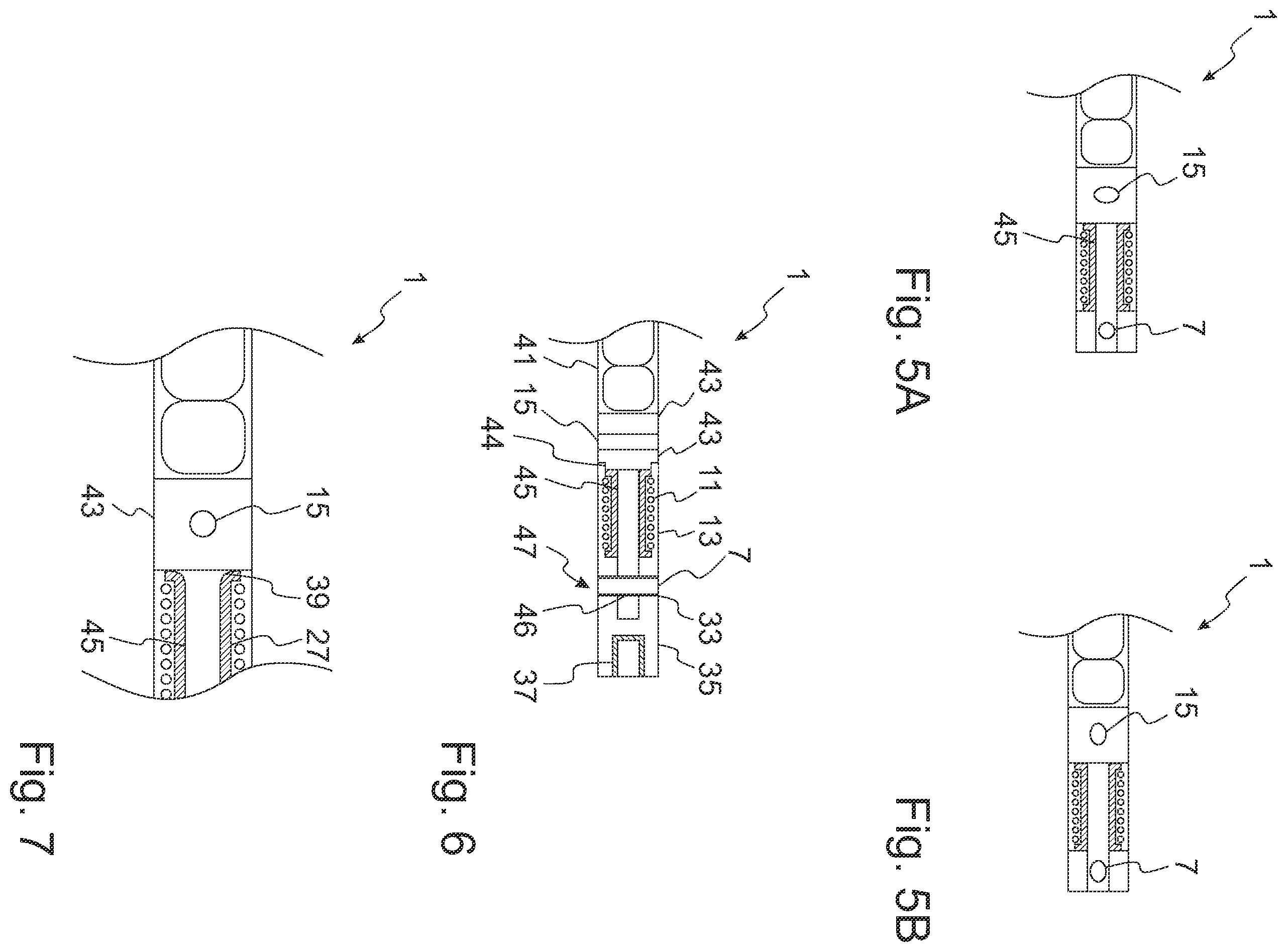Patent US12324612 Figure 3 – Intramedullary nail for distracting a long bone