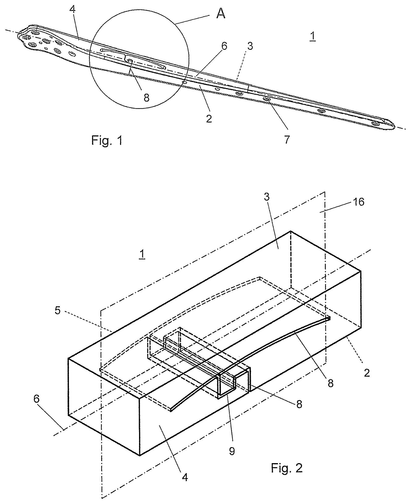 Patent US12324613 — Biphasic bone plate — Figure 1