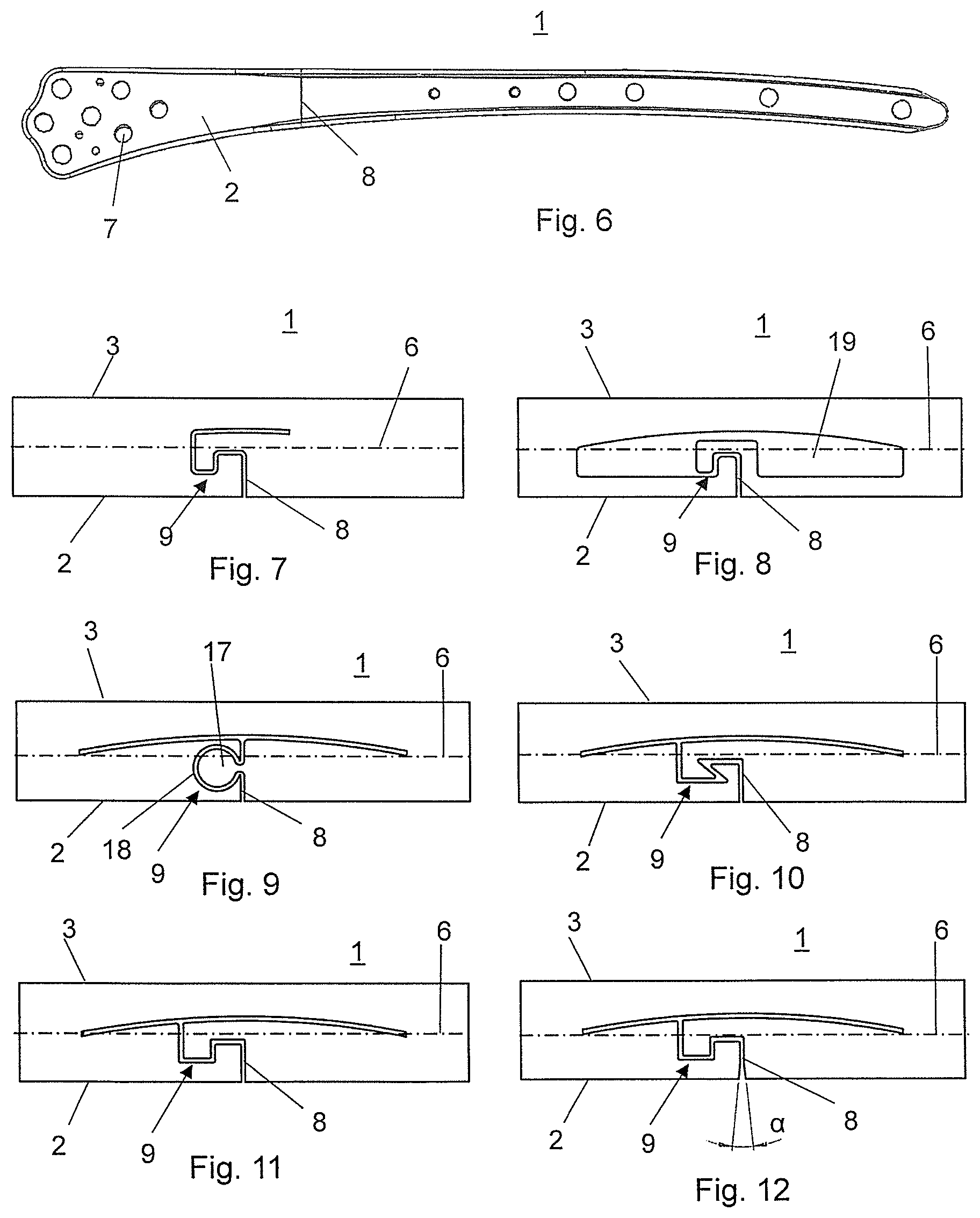 Patent US12324613 Figure 3 – Biphasic bone plate