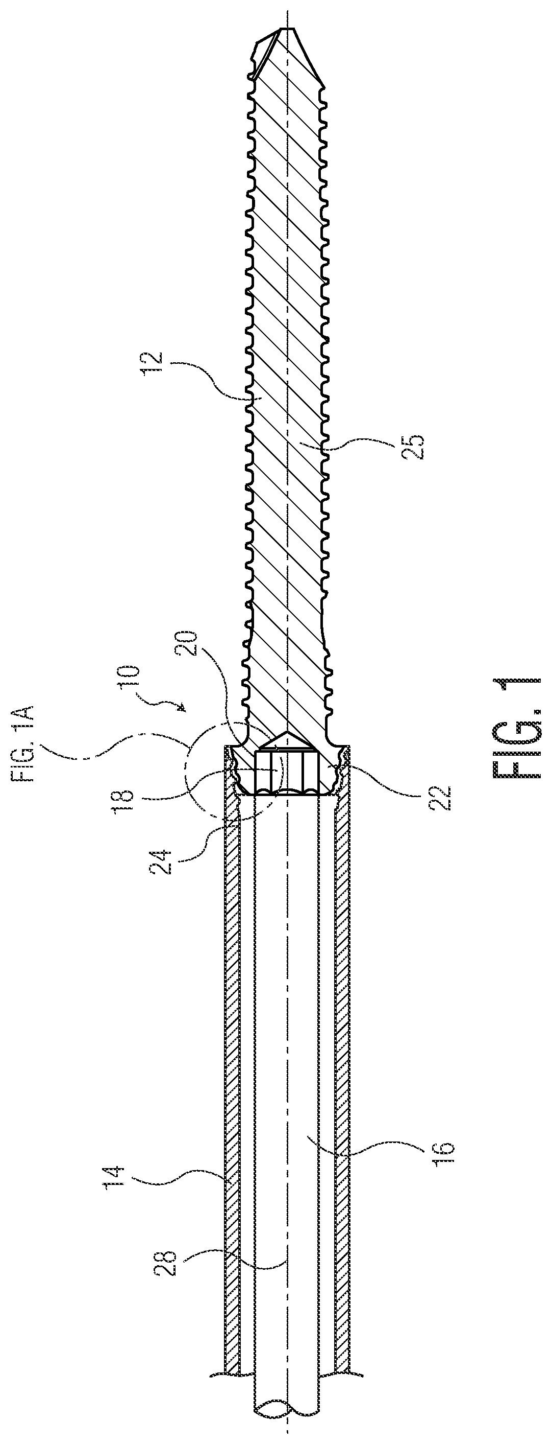 Patent US12324614 Figure 1 – Self-holding screw head