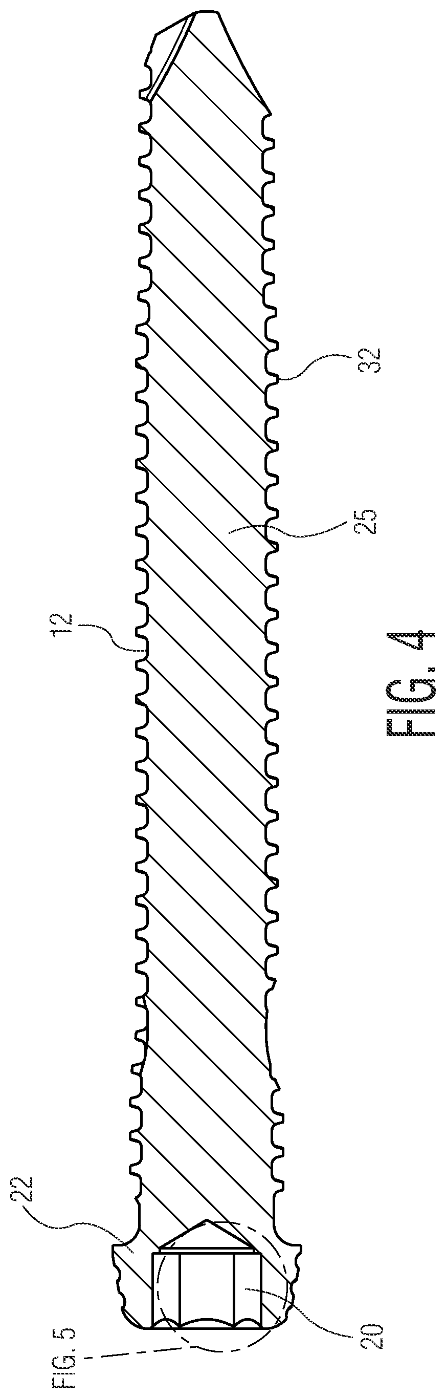 Patent US12324614 Figure 6 – Self-holding screw head