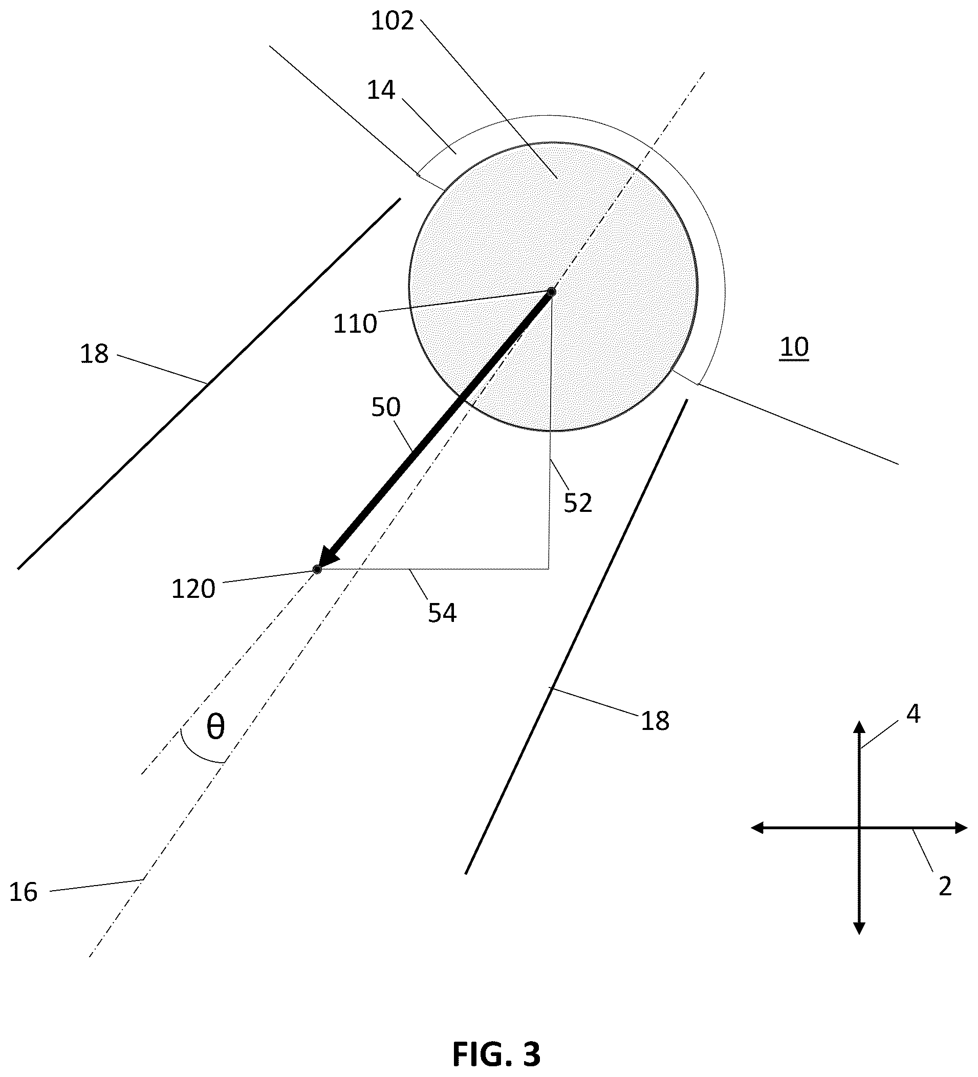 Patent US12324615 Figure 2 – Assessment of soft tissue tension in hip procedures