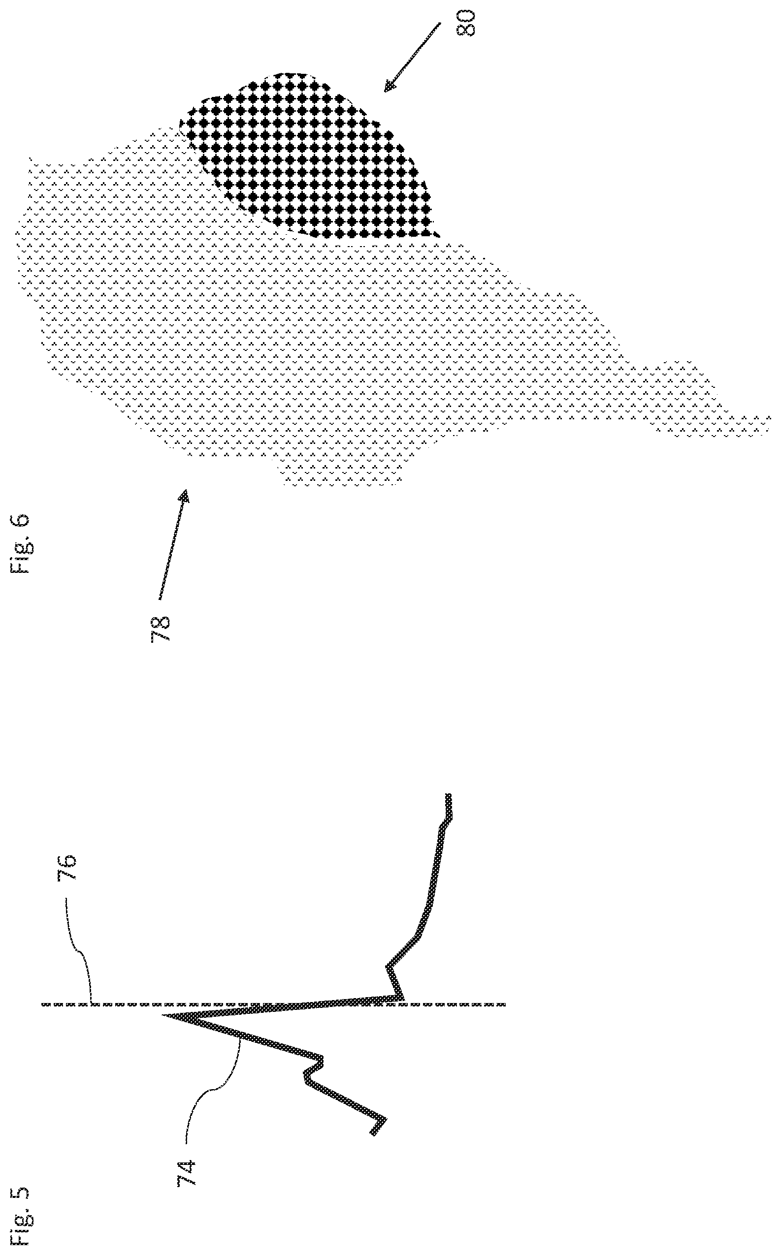 Patent US12324619 Figure 4 – Automatic anatomical feature identification and map segmentation