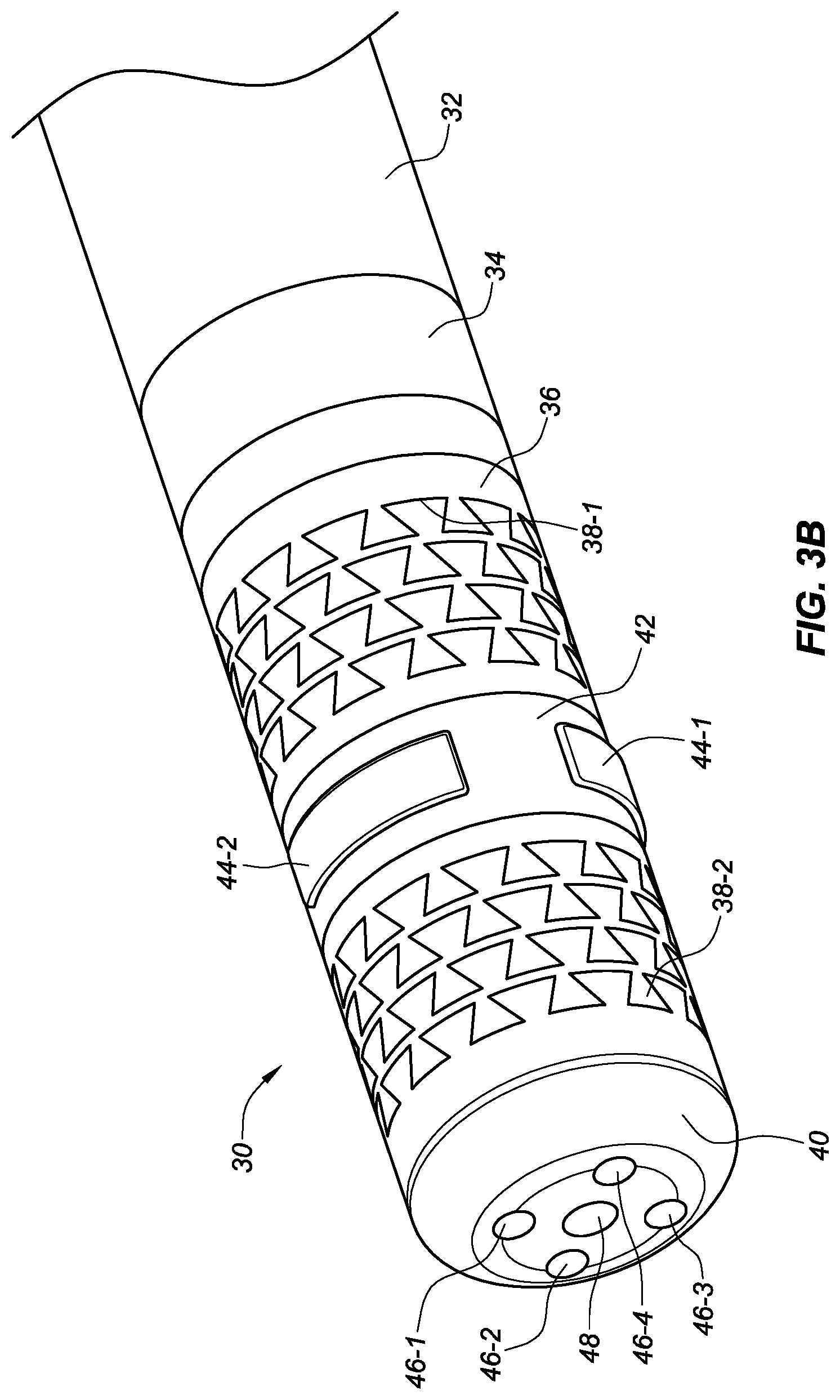Patent US12324620 Figure 4 – Ablation catheter with electrodes
