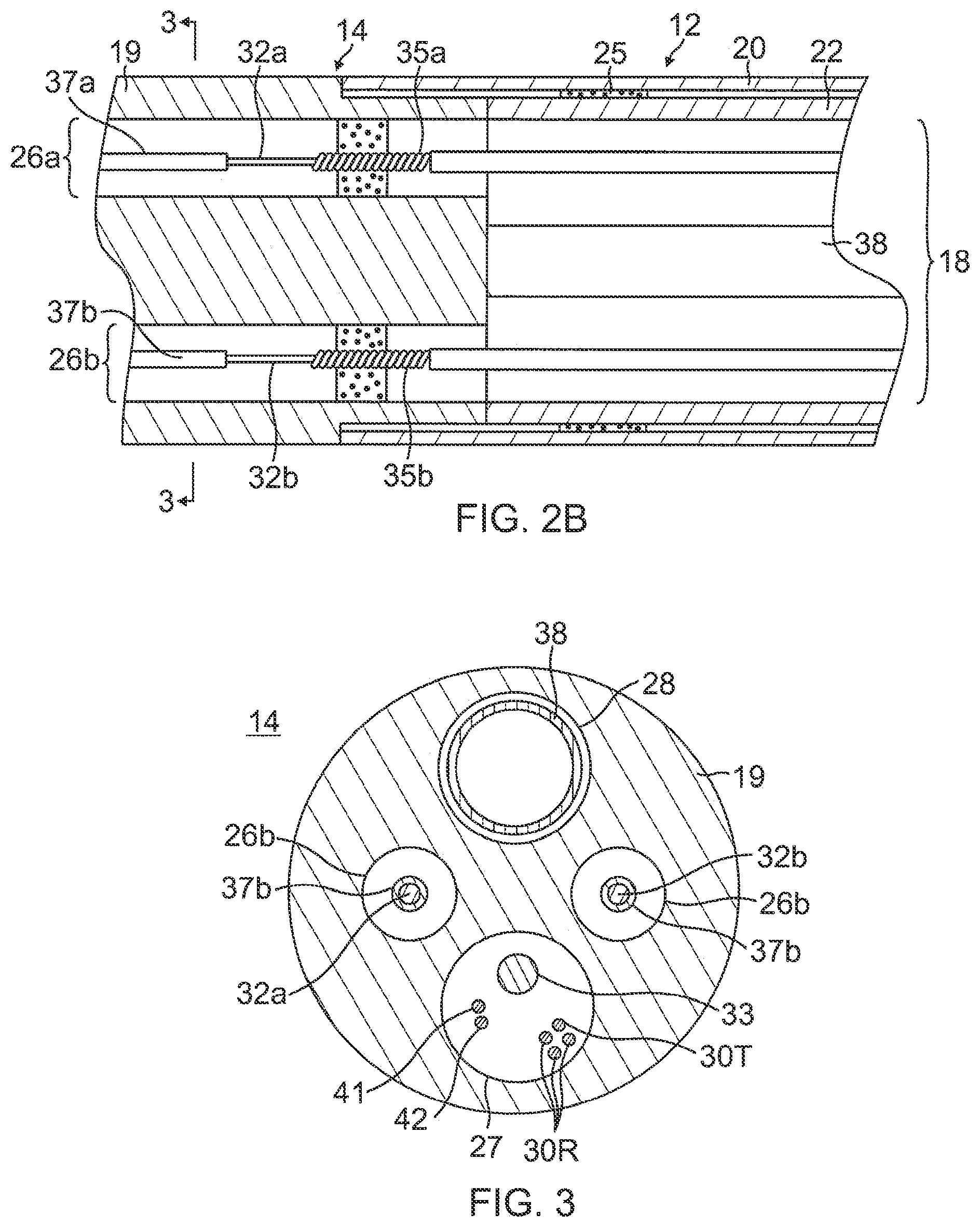 Patent US12324621 Figure 3 – Catheter with improved irrigated tip electrode having two-piece construction, and method of manufacturing therefor