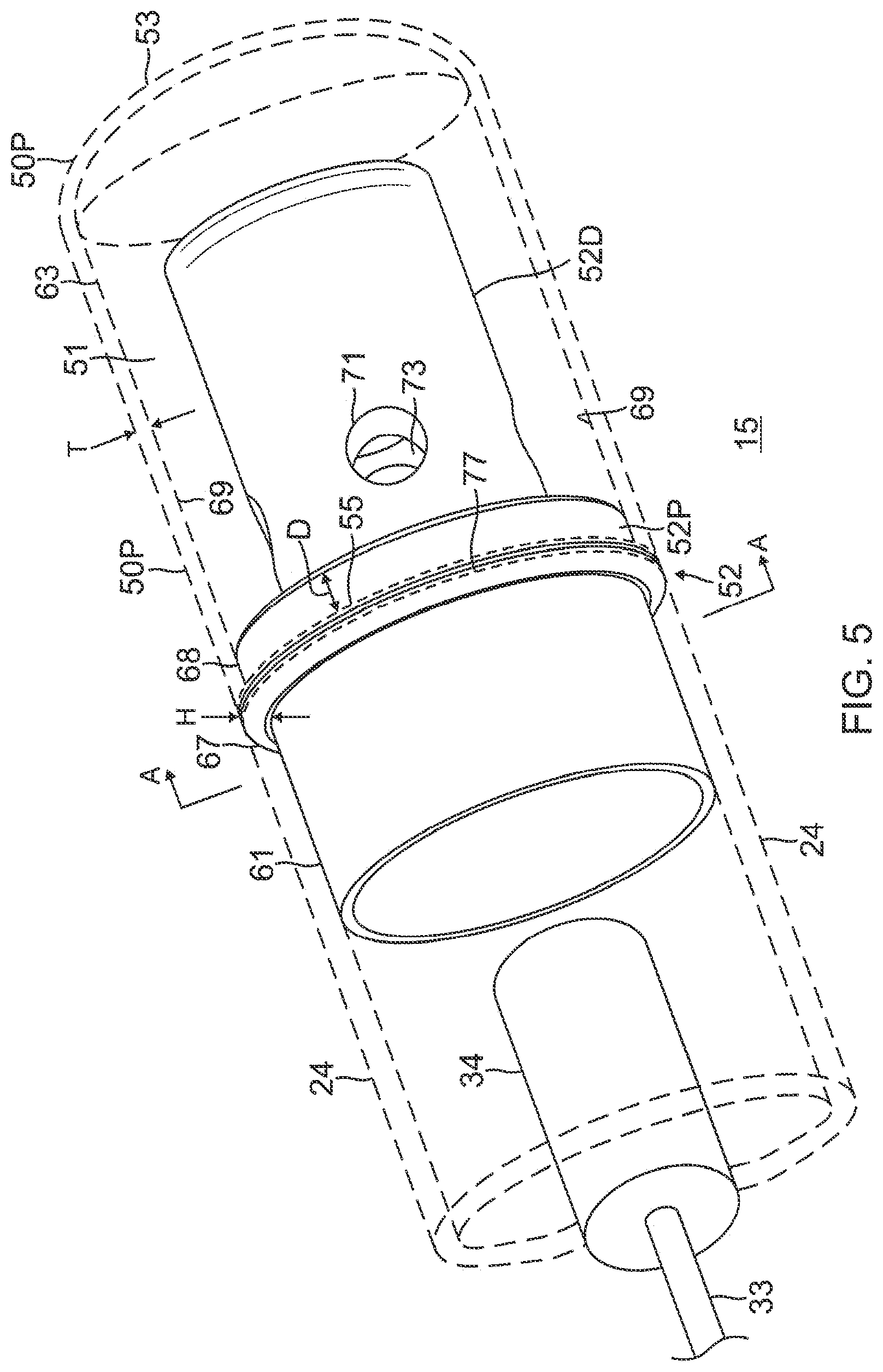 Patent US12324621 Figure 5 – Catheter with improved irrigated tip electrode having two-piece construction, and method of manufacturing therefor