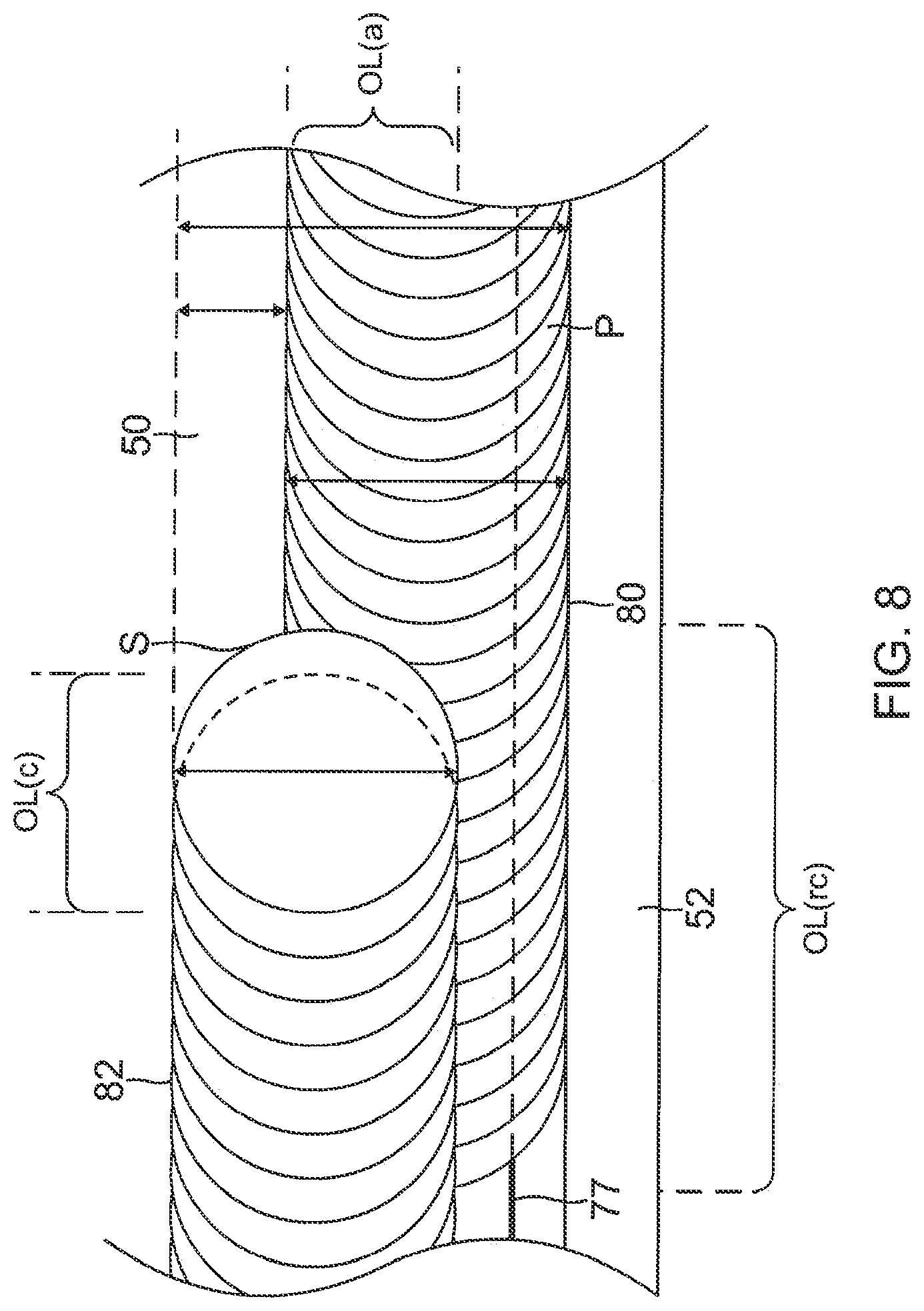 Patent US12324621 Figure 7 – Catheter with improved irrigated tip electrode having two-piece construction, and method of manufacturing therefor