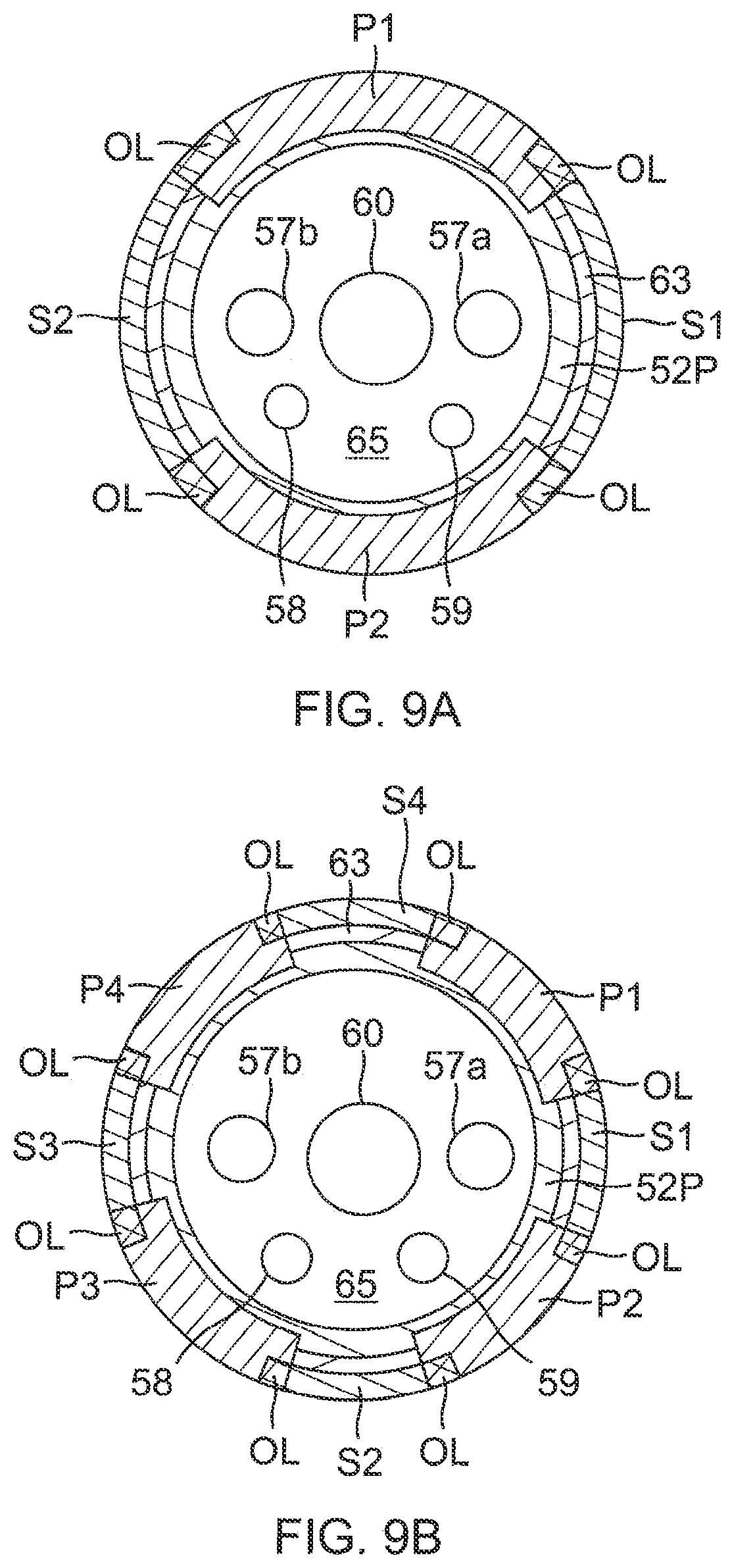 Patent US12324621 Figure 8 – Catheter with improved irrigated tip electrode having two-piece construction, and method of manufacturing therefor