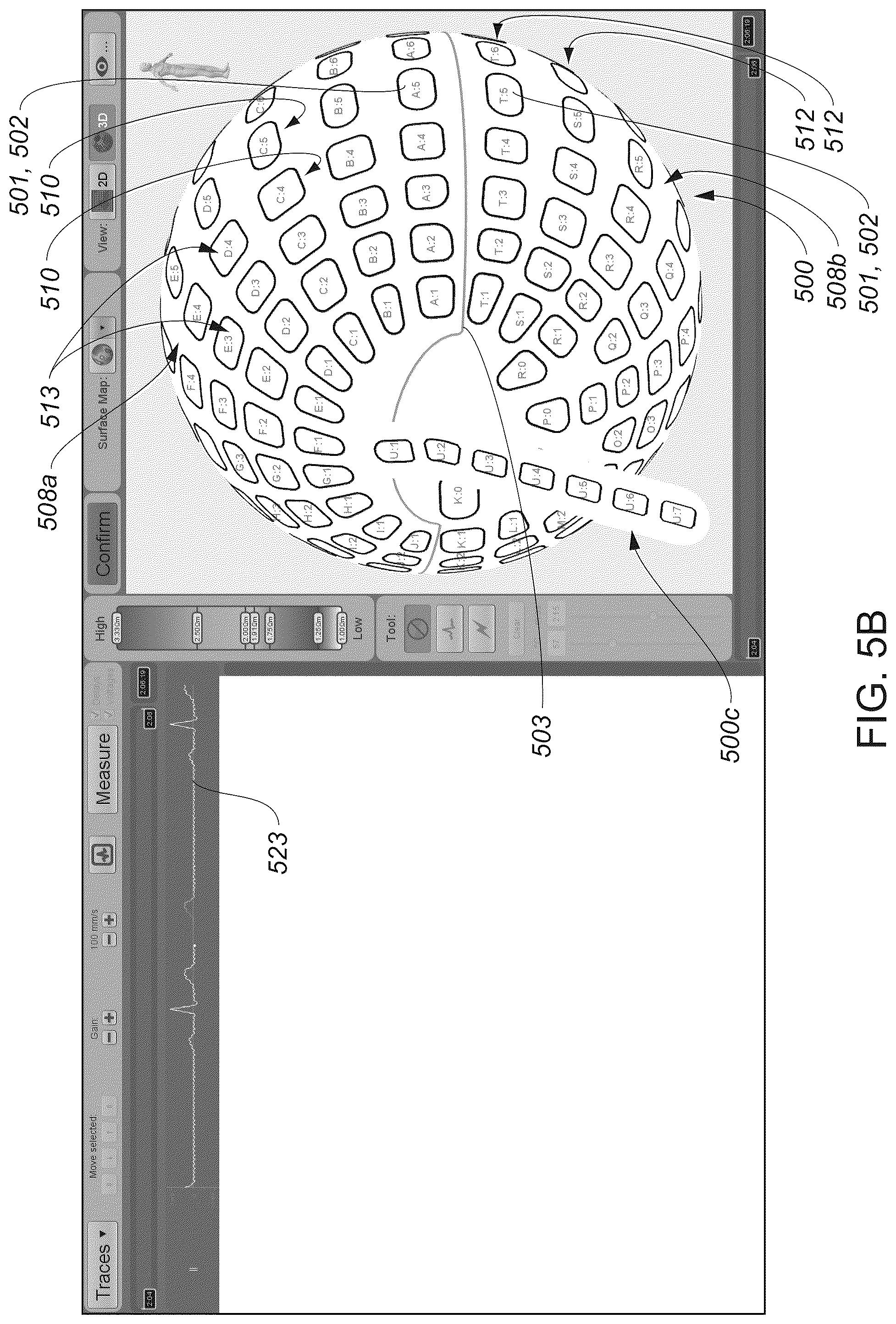Patent US12324622 Figure 9 – Systems and methods for ablating tissue