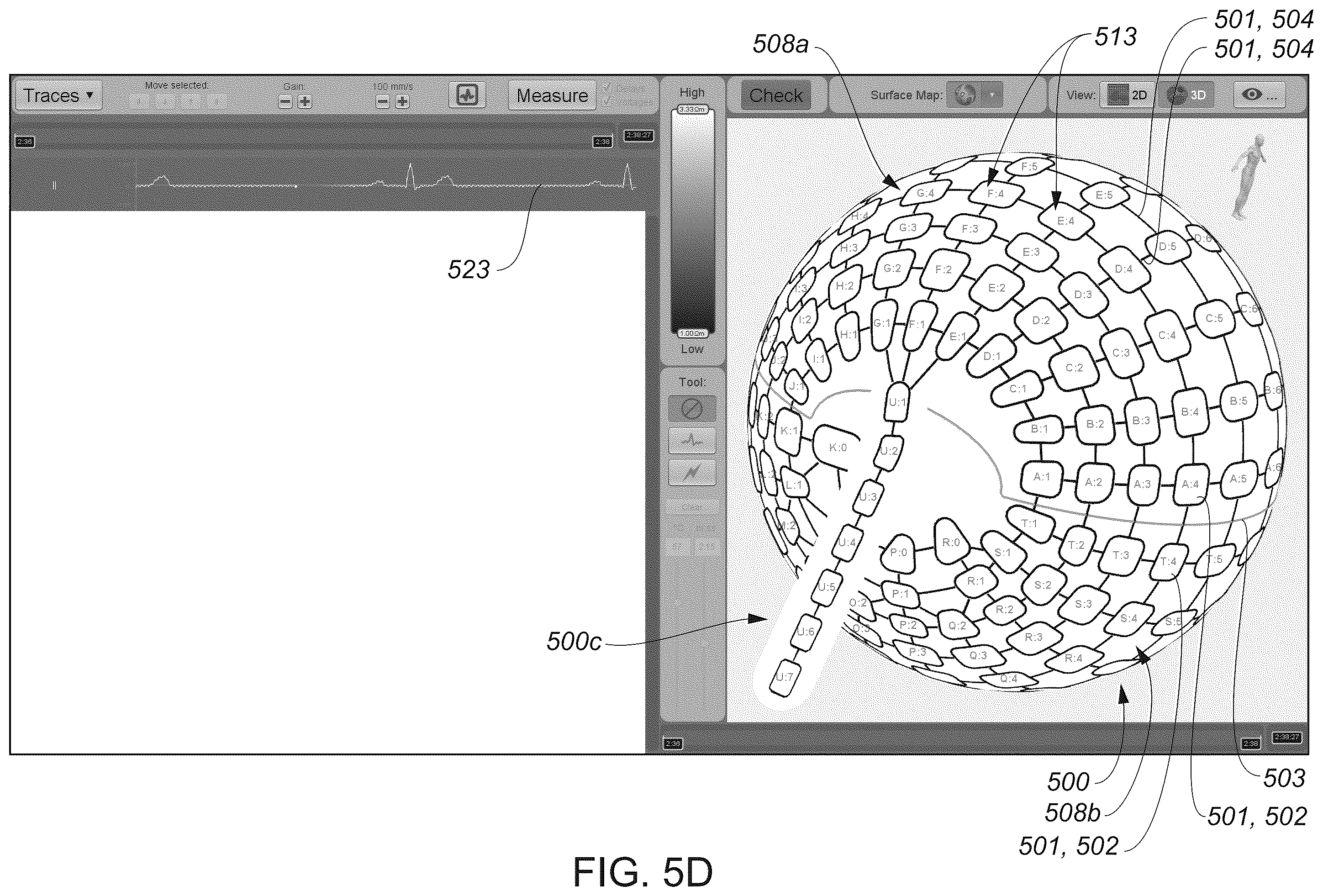 Patent US12324622 Figure 11 – Systems and methods for ablating tissue