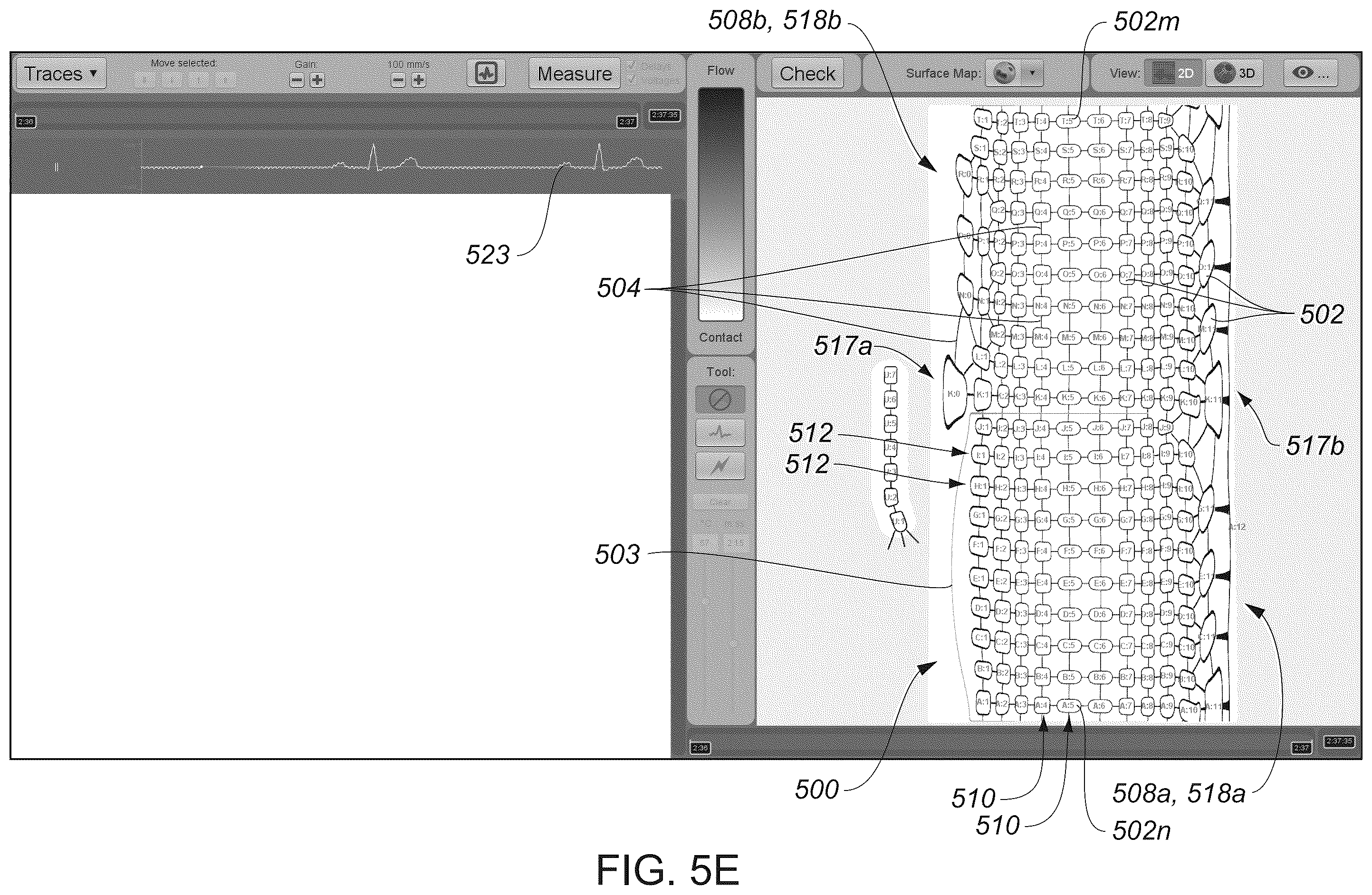 Patent US12324622 Figure 12 – Systems and methods for ablating tissue