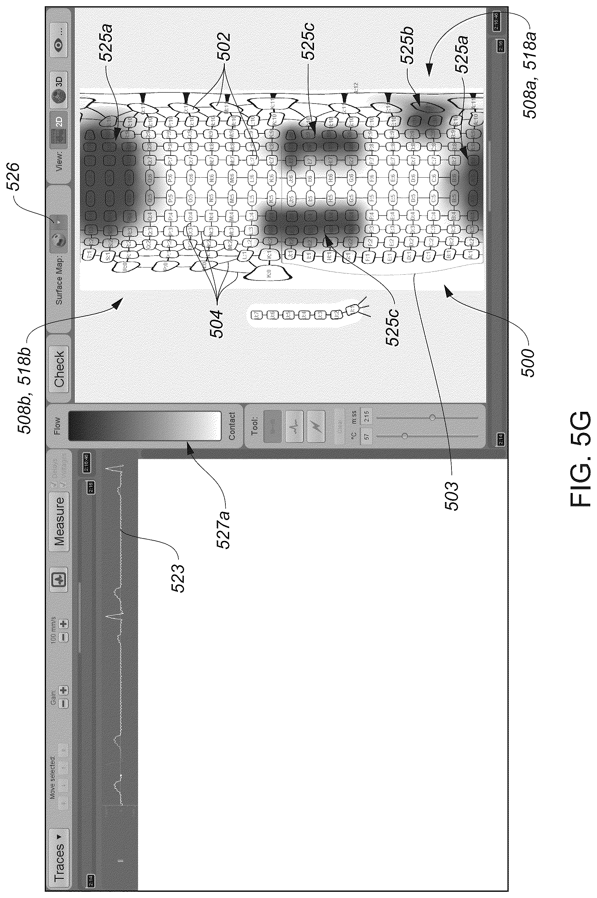 Patent US12324622 Figure 14 – Systems and methods for ablating tissue