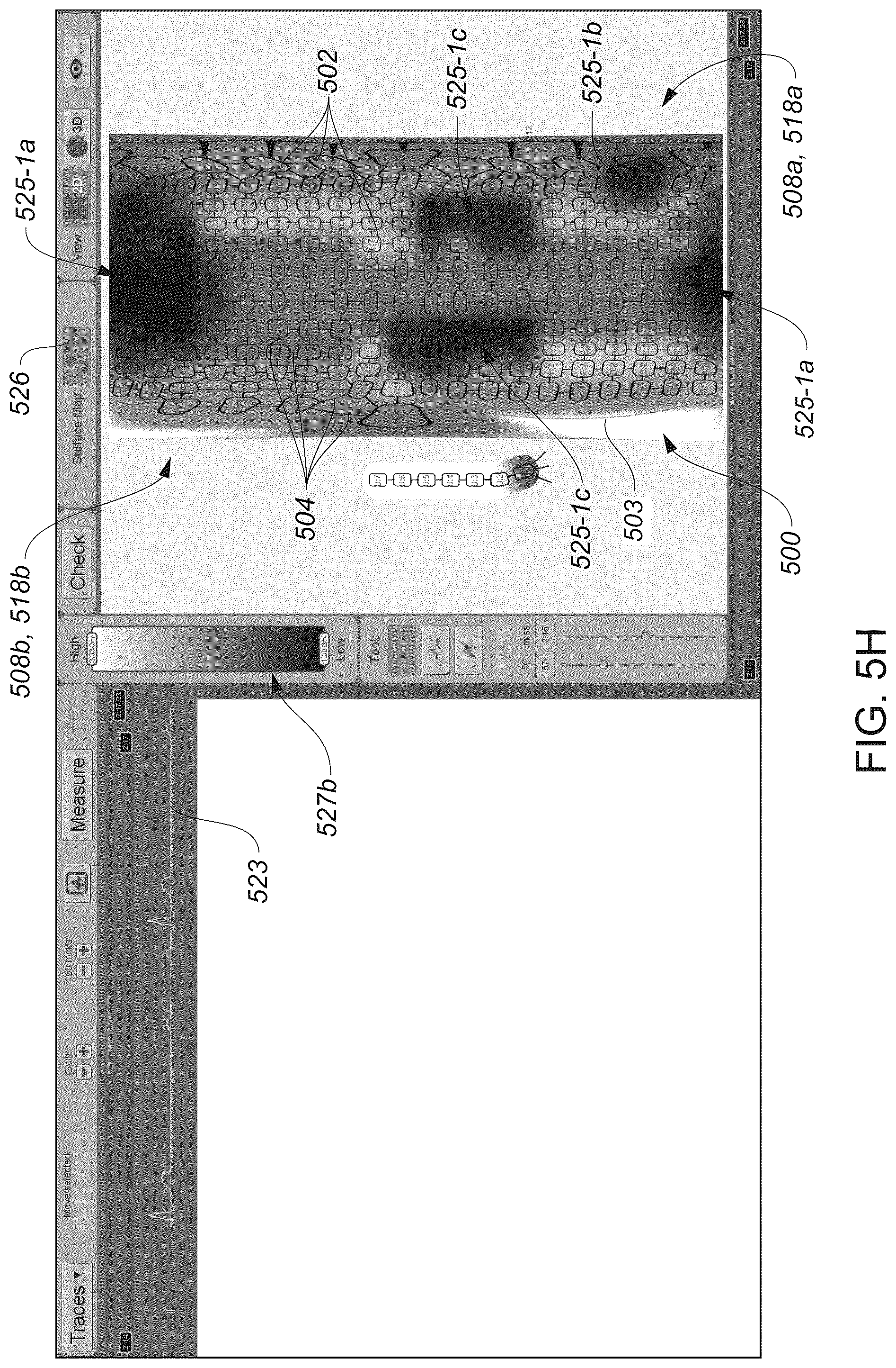 Patent US12324622 Figure 15 – Systems and methods for ablating tissue