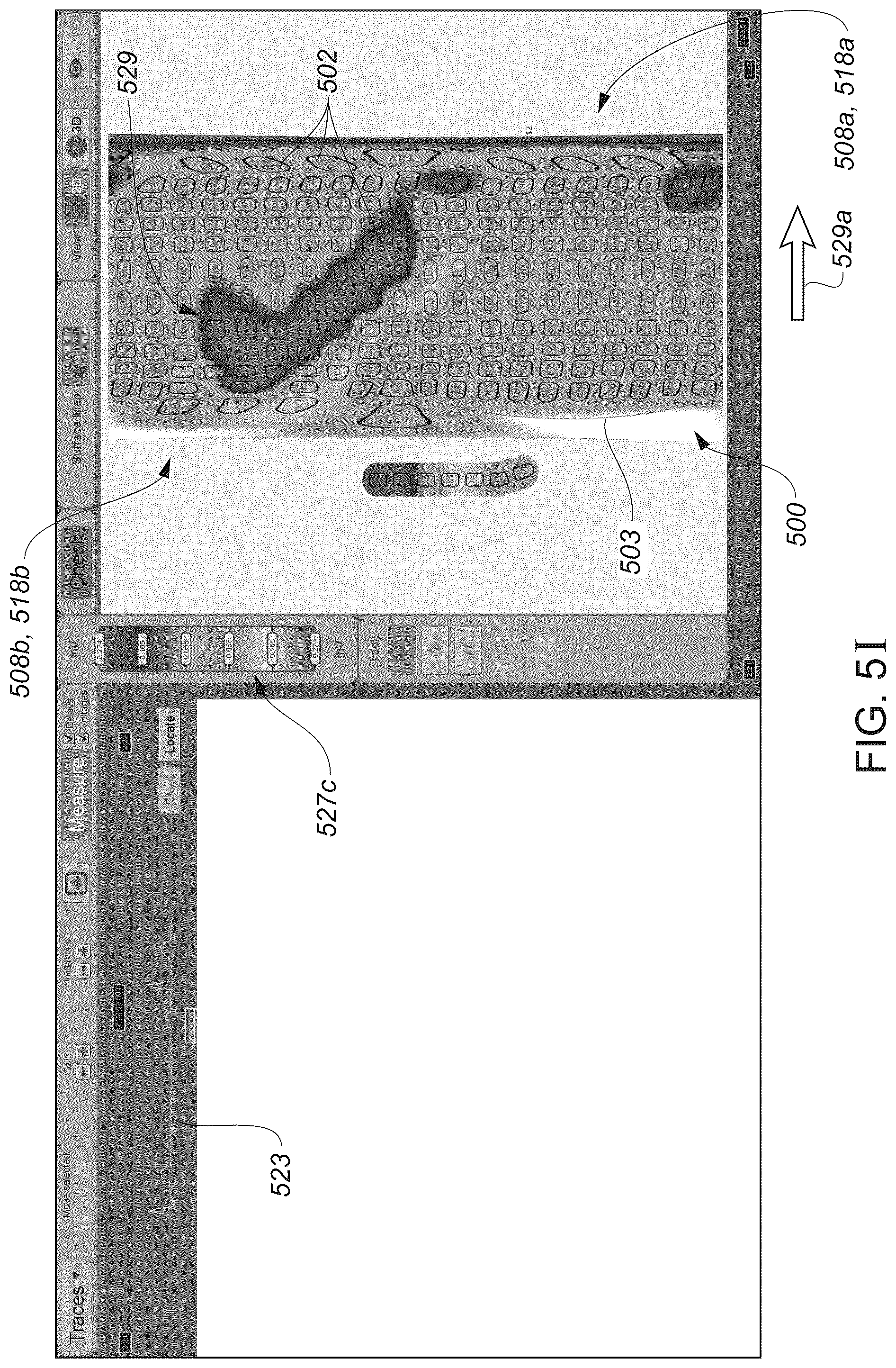 Patent US12324622 Figure 16 – Systems and methods for ablating tissue