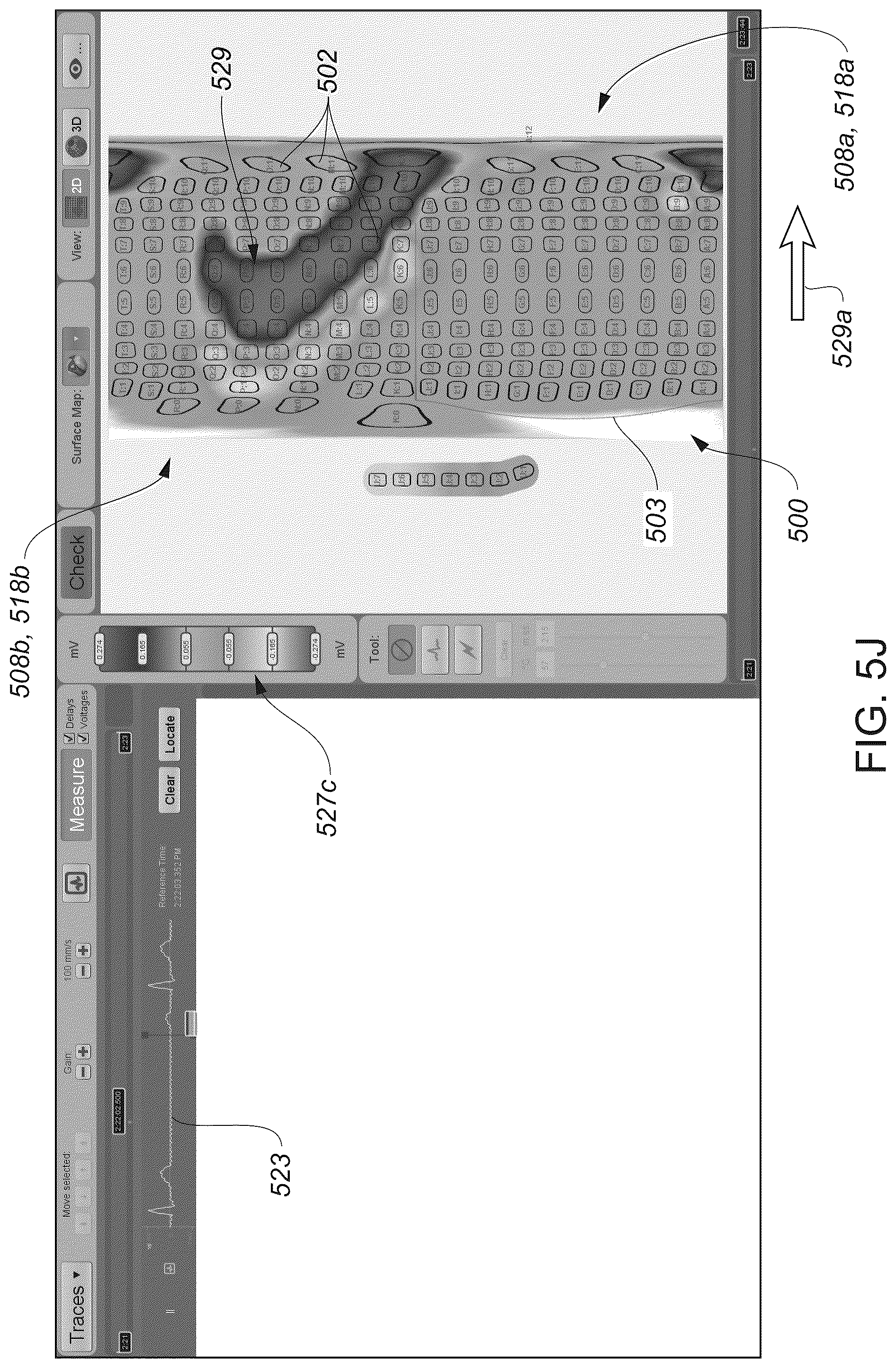 Patent US12324622 Figure 17 – Systems and methods for ablating tissue