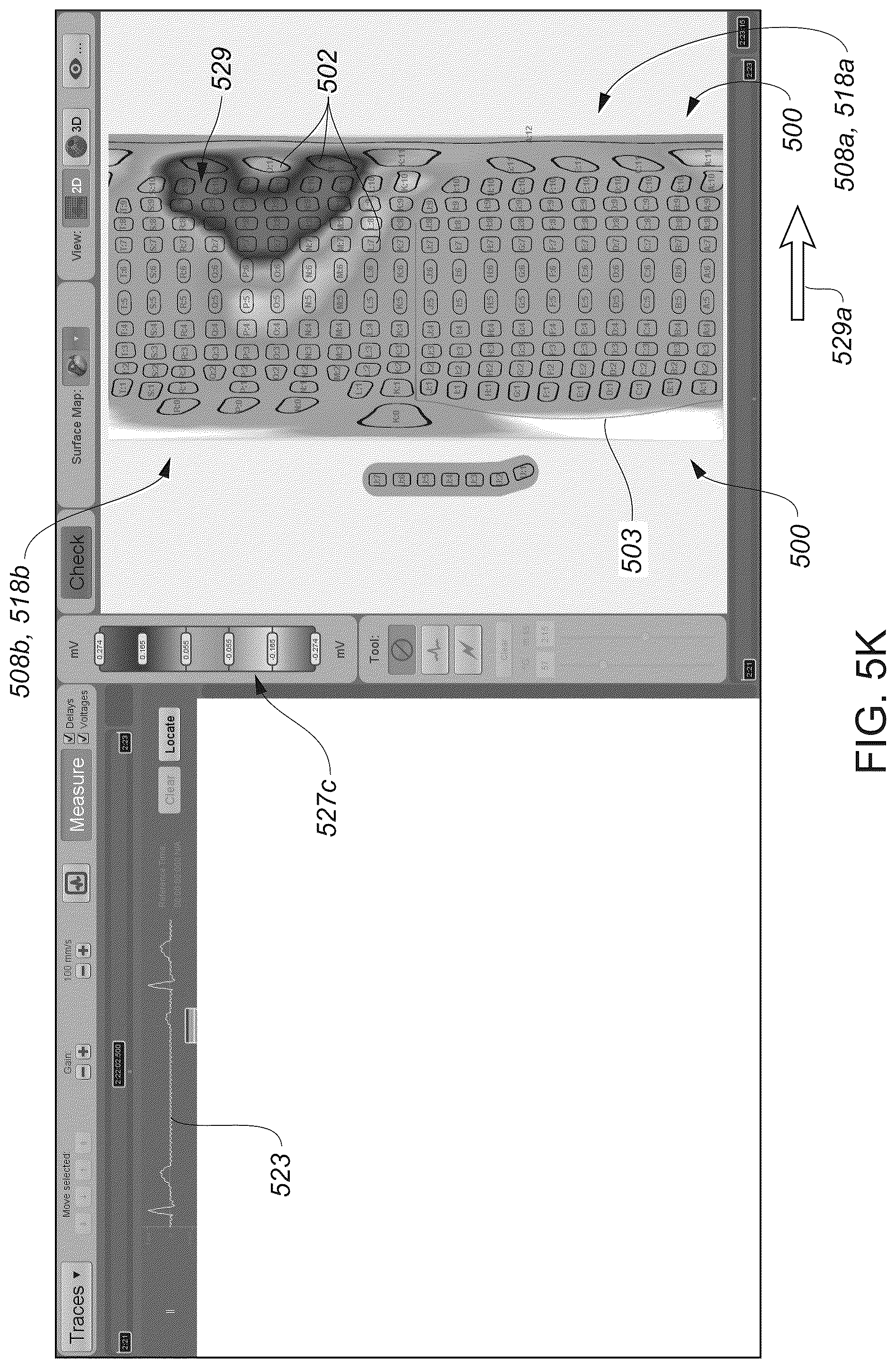 Patent US12324622 Figure 18 – Systems and methods for ablating tissue
