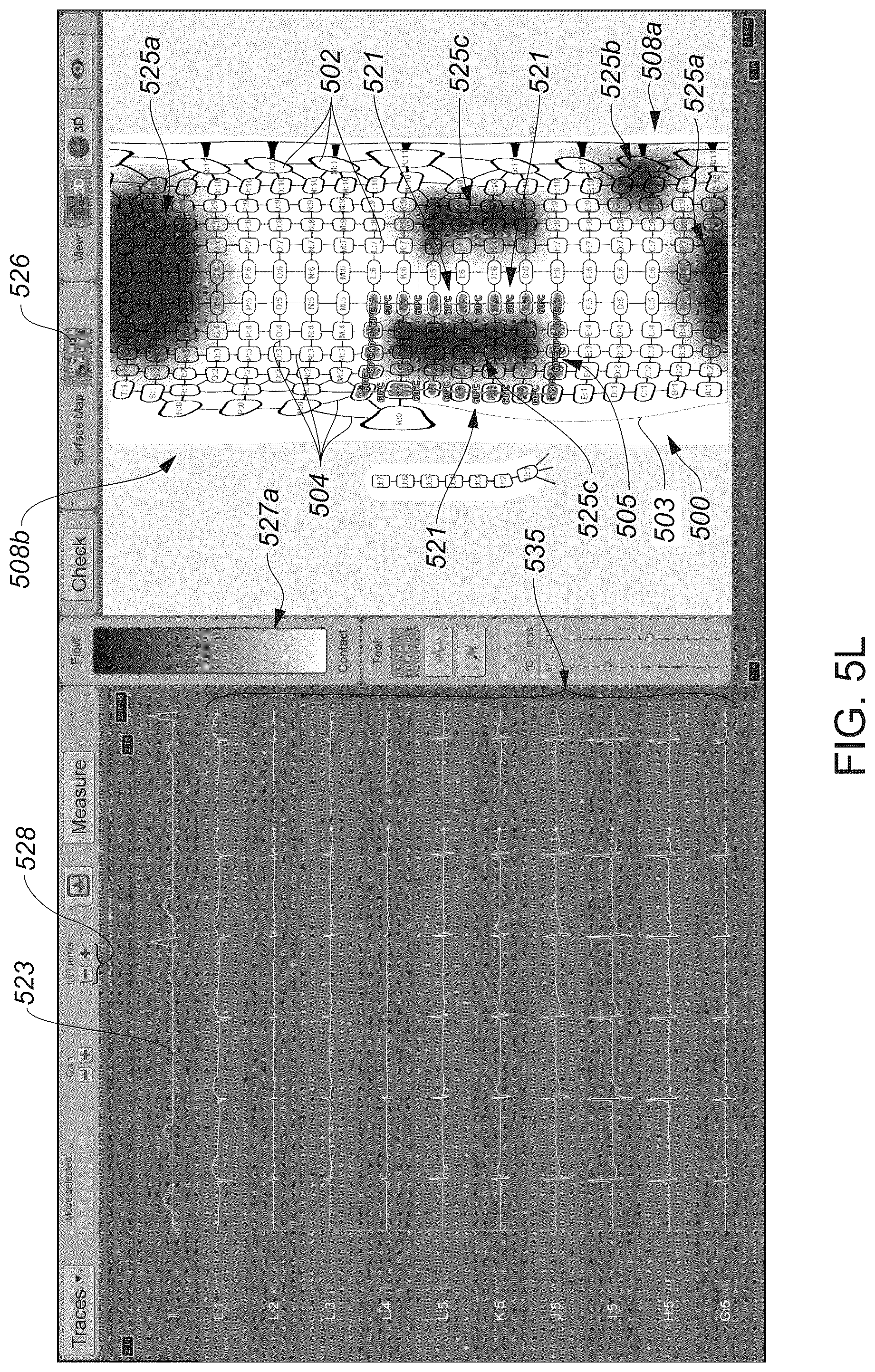 Patent US12324622 Figure 19 – Systems and methods for ablating tissue