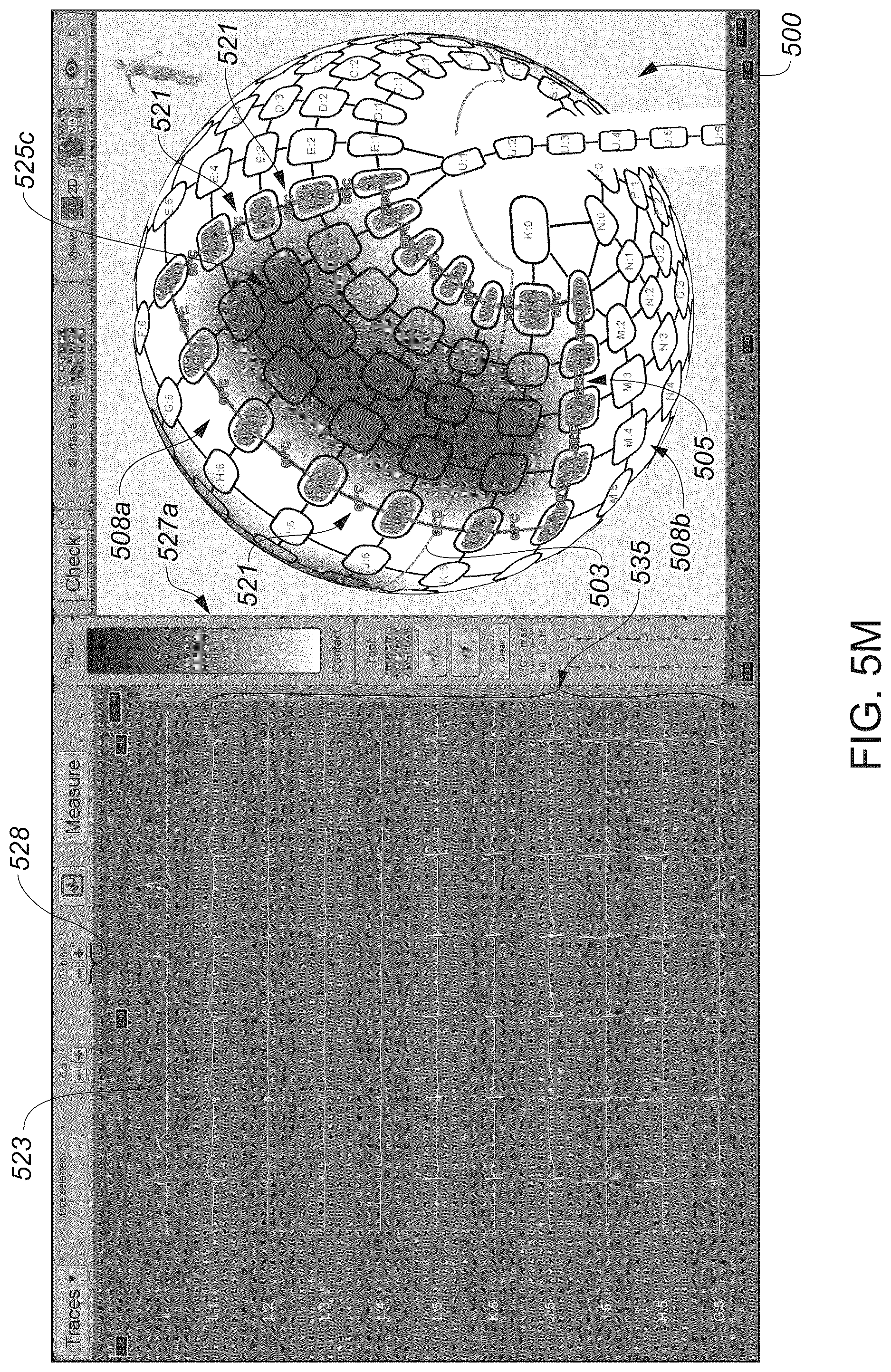 Patent US12324622 Figure 20 – Systems and methods for ablating tissue