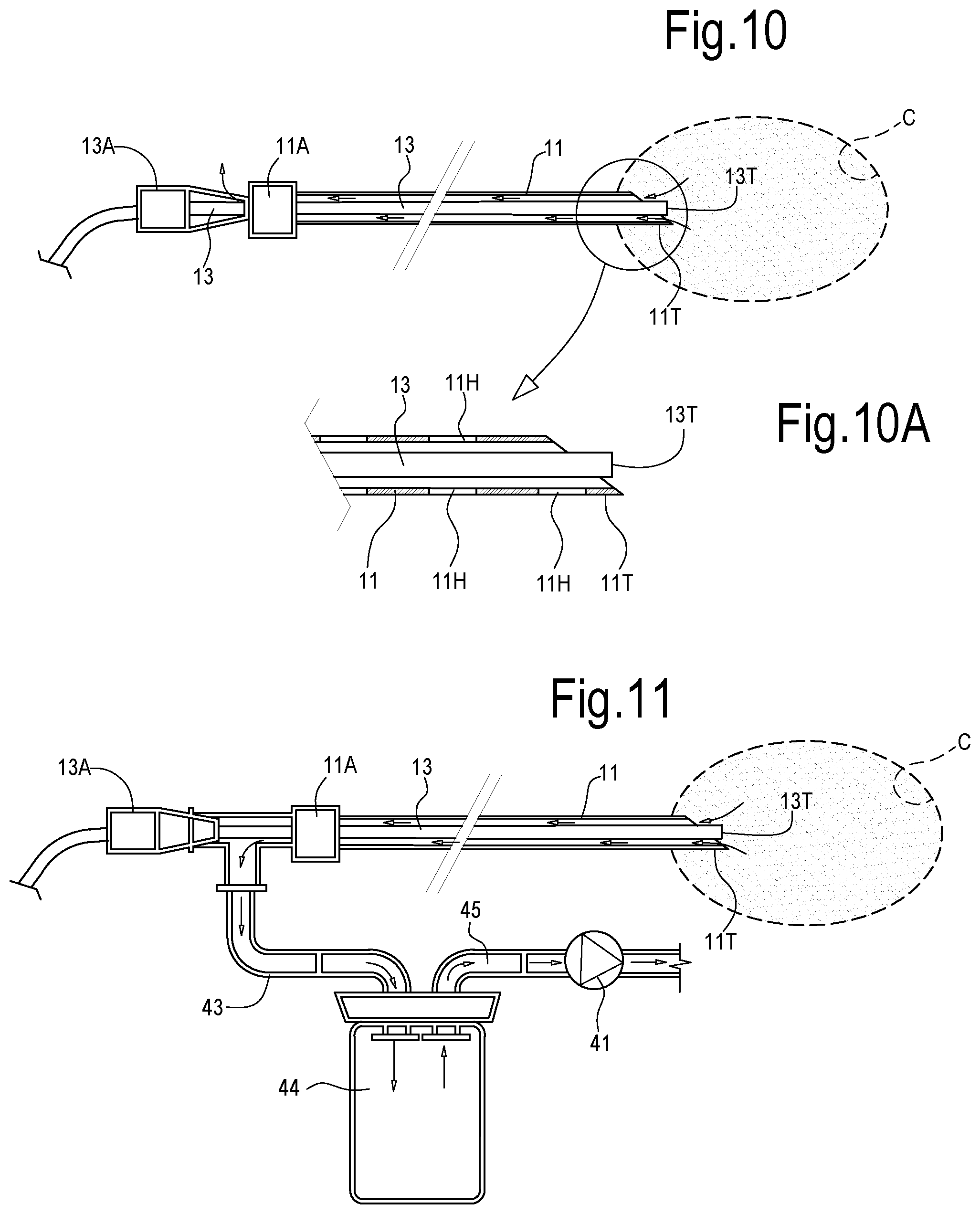 Patent US12324623 Figure 7 – Laser treatment of the prostate