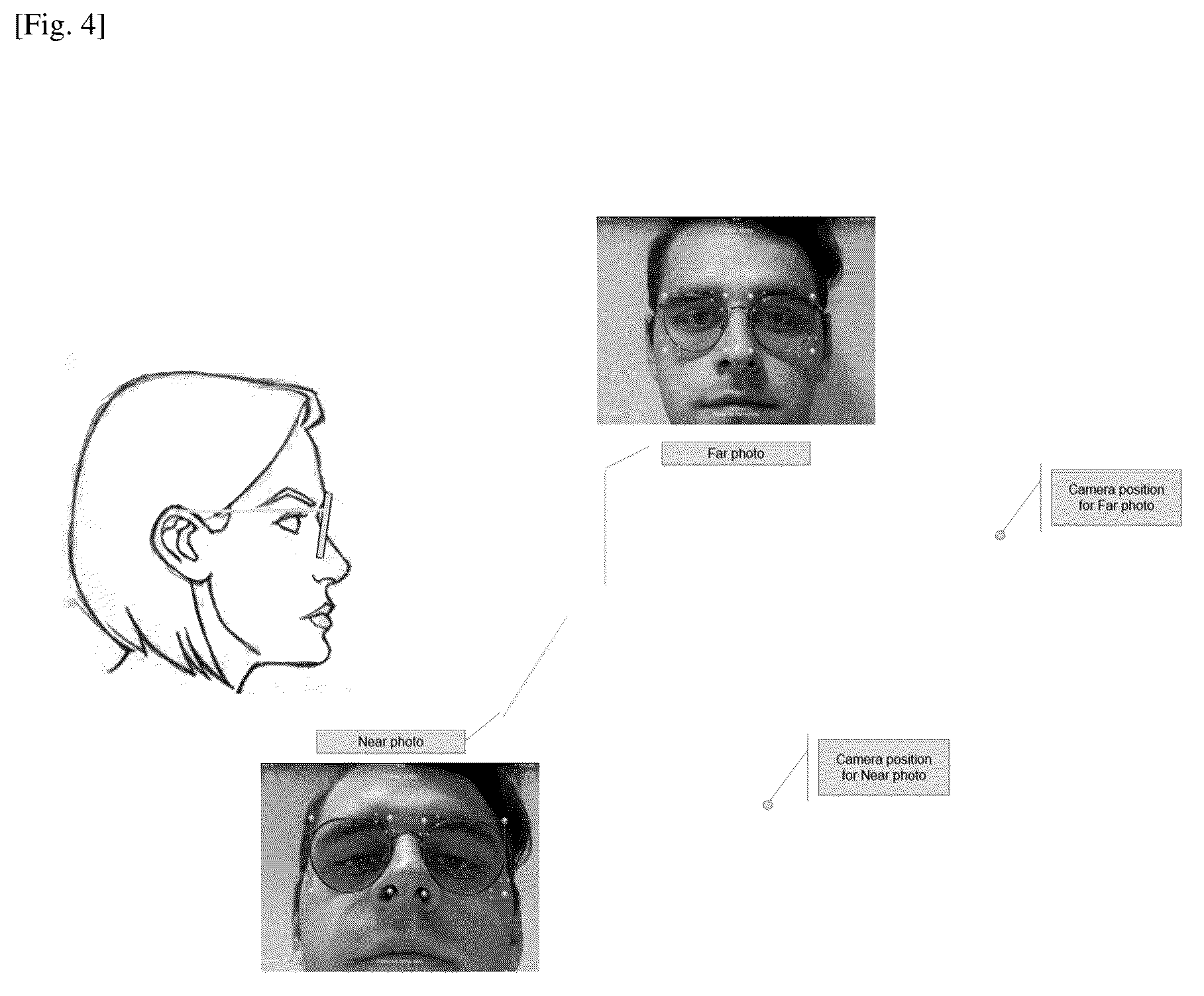 Patent US12324626 Figure 4 – Process for determining ophthalmic parameters by 3D mapping