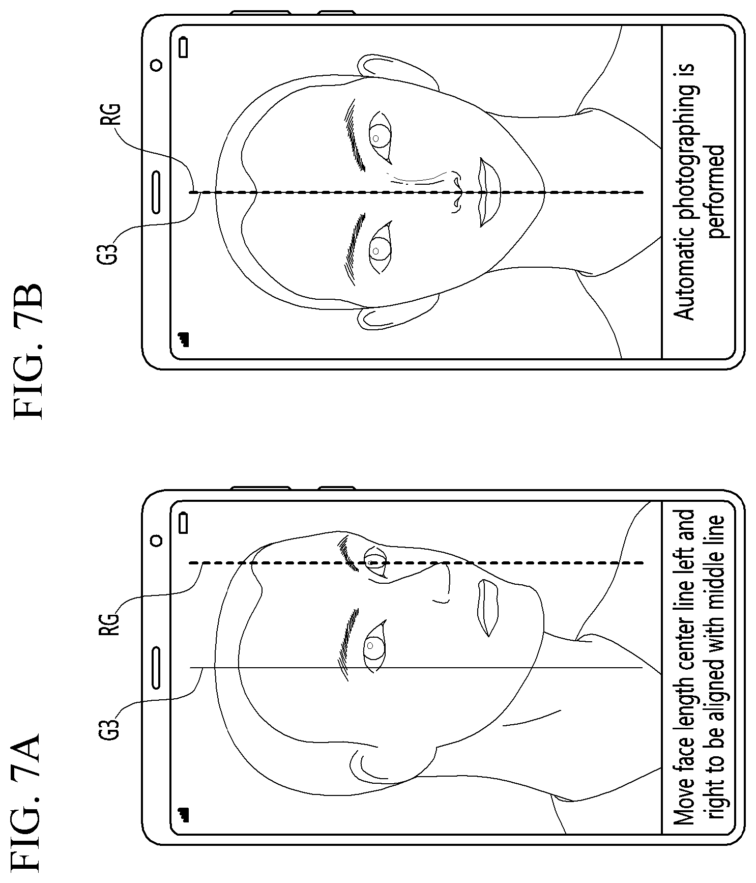 Patent US12324628 Figure 7 – Method and photographing device for acquiring side image for ocular proptosis degree analysis, and recording medium therefor