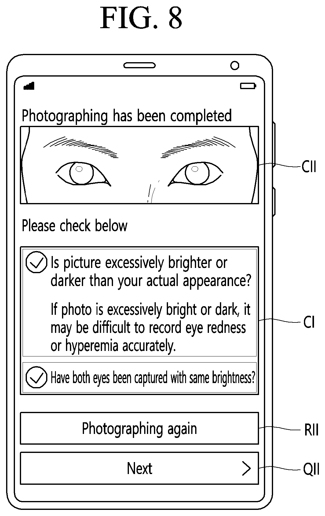 Patent US12324628 Figure 8 – Method and photographing device for acquiring side image for ocular proptosis degree analysis, and recording medium therefor