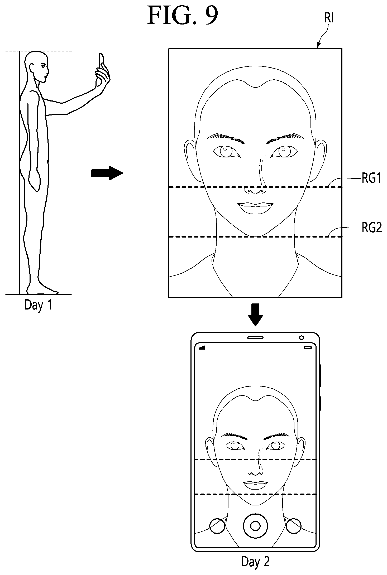 Patent US12324628 Figure 9 – Method and photographing device for acquiring side image for ocular proptosis degree analysis, and recording medium therefor
