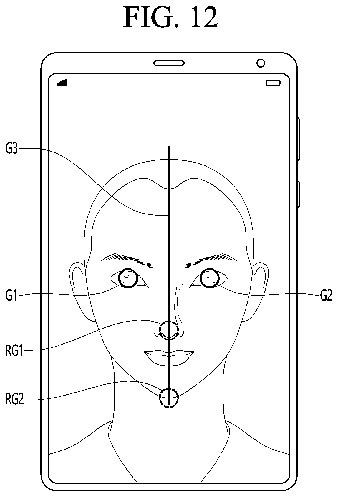 Patent US12324628 Figure 12 – Method and photographing device for acquiring side image for ocular proptosis degree analysis, and recording medium therefor