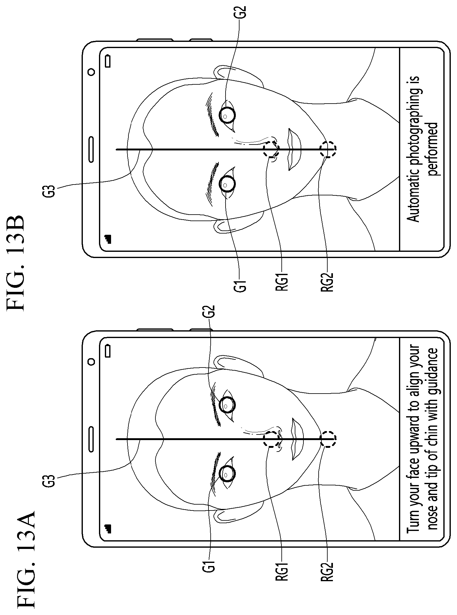 Patent US12324628 Figure 13 – Method and photographing device for acquiring side image for ocular proptosis degree analysis, and recording medium therefor