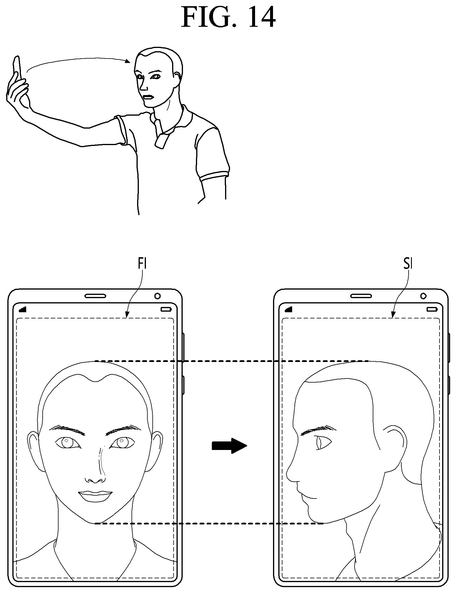 Patent US12324628 Figure 14 – Method and photographing device for acquiring side image for ocular proptosis degree analysis, and recording medium therefor