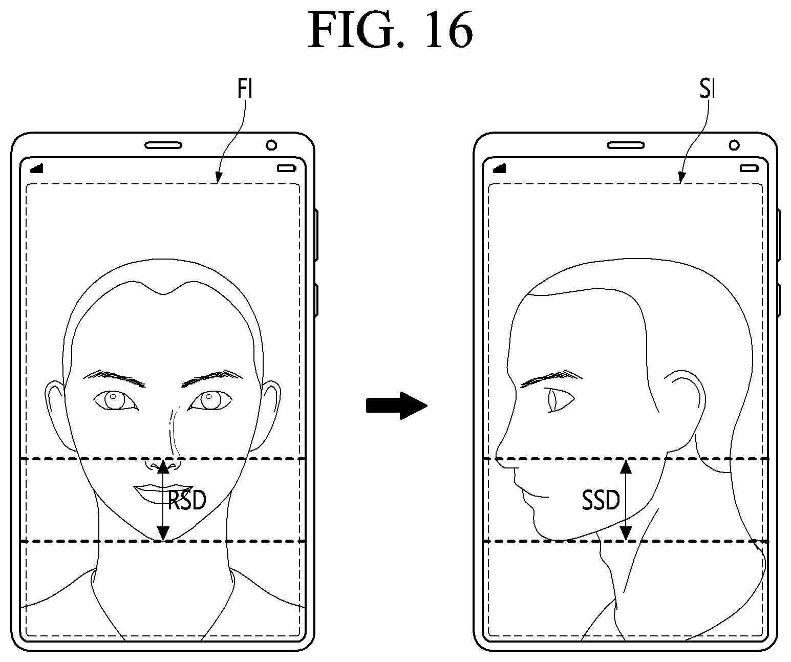 Patent US12324628 Figure 16 – Method and photographing device for acquiring side image for ocular proptosis degree analysis, and recording medium therefor