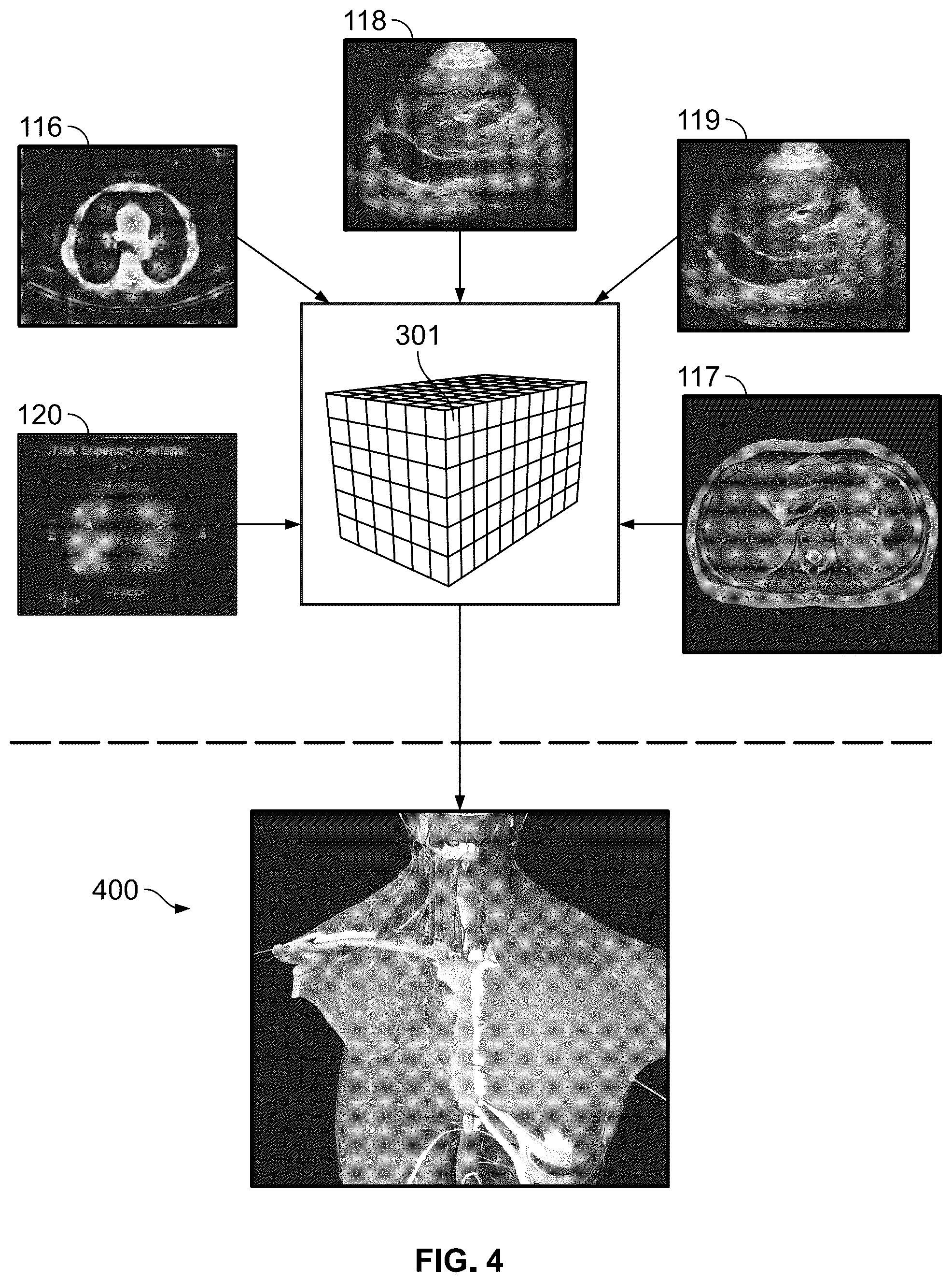 Patent US12324629 Figure 3 – Method for determination of surgical procedure access