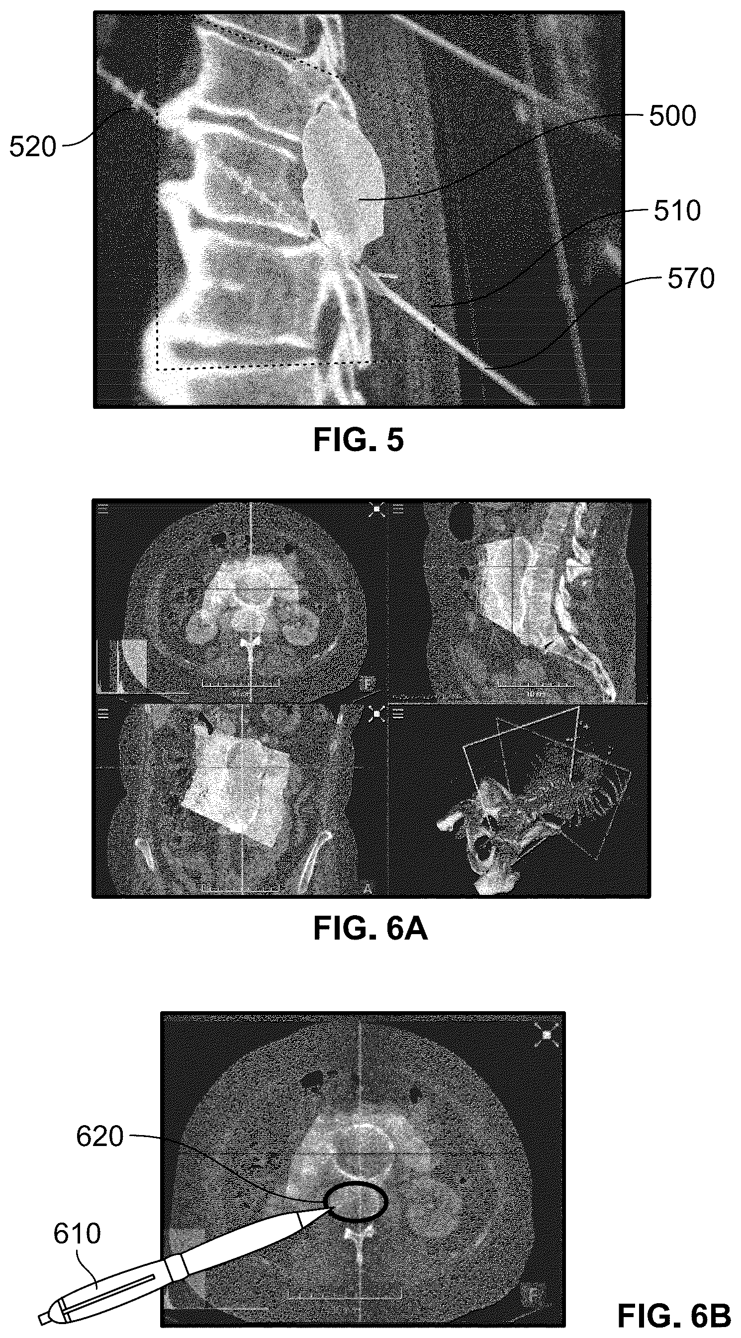 Patent US12324629 Figure 4 – Method for determination of surgical procedure access
