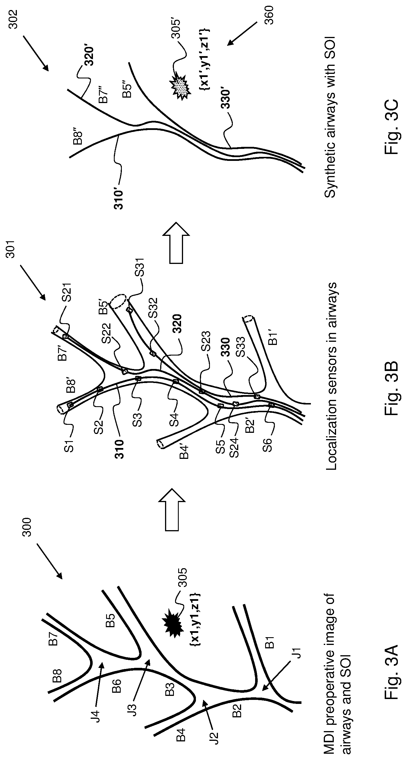 Patent US12324635 Figure 5 – Systems and methods for providing surgical guidance