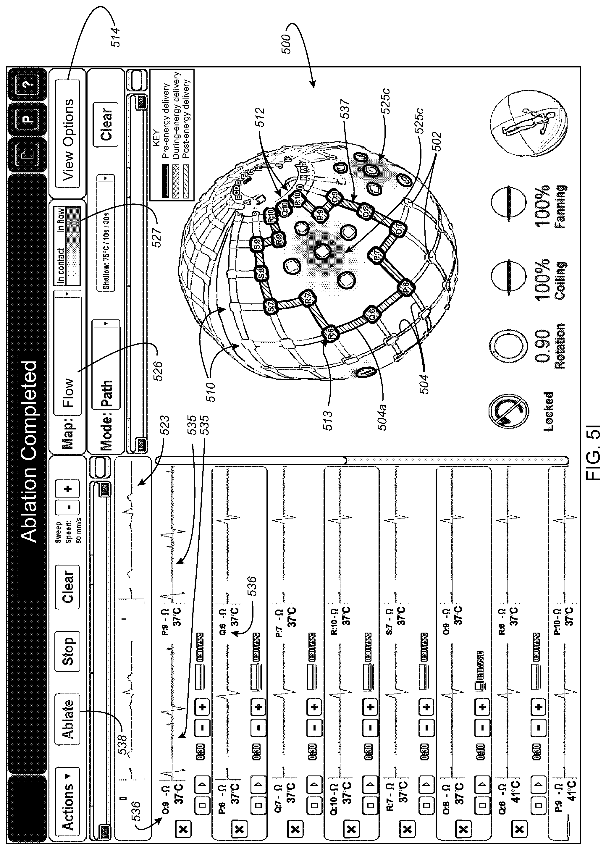 Patent US12324636 Figure 14 – Systems and methods for selecting, activating, or selecting and activating transducers