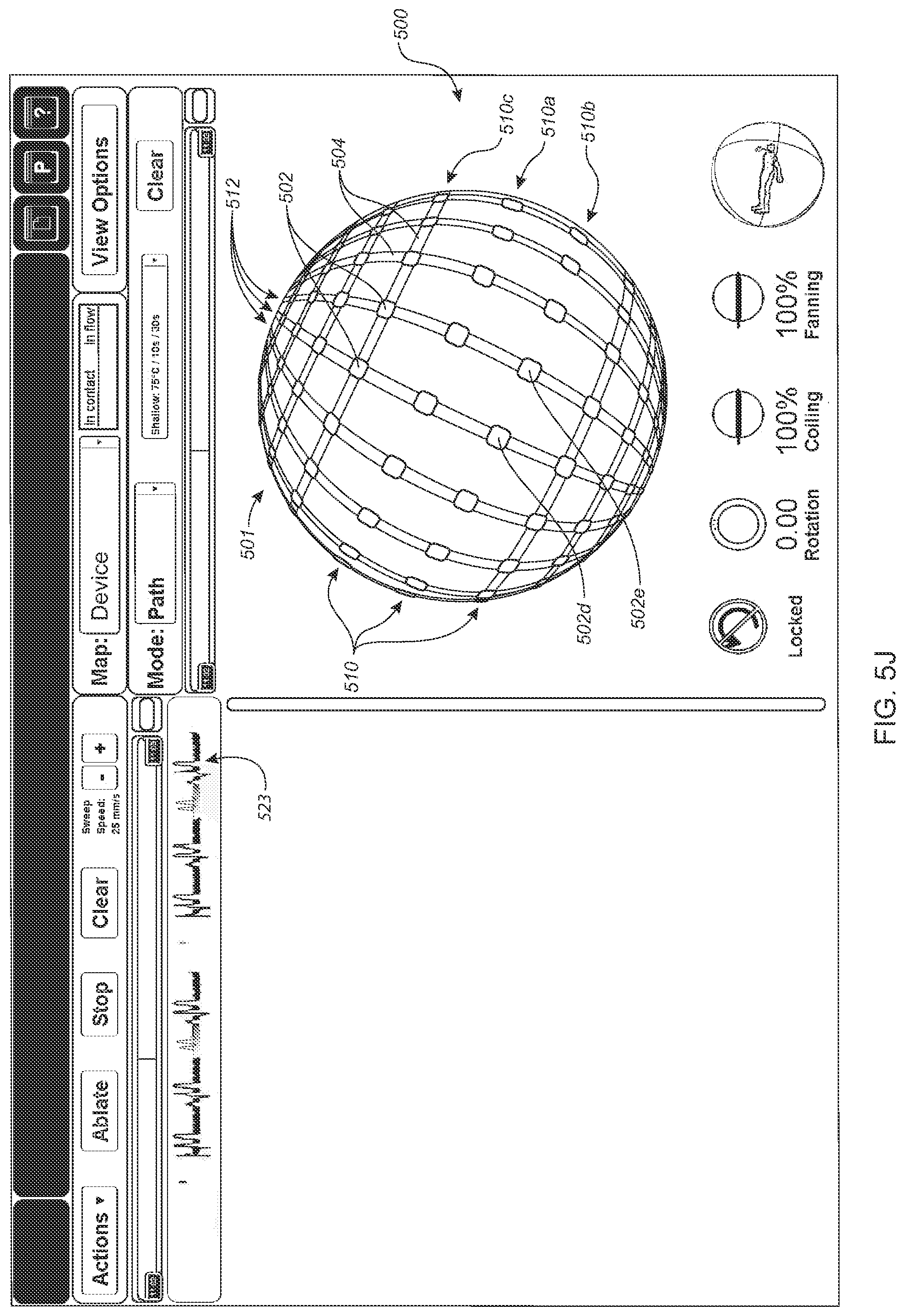 Patent US12324636 Figure 15 – Systems and methods for selecting, activating, or selecting and activating transducers