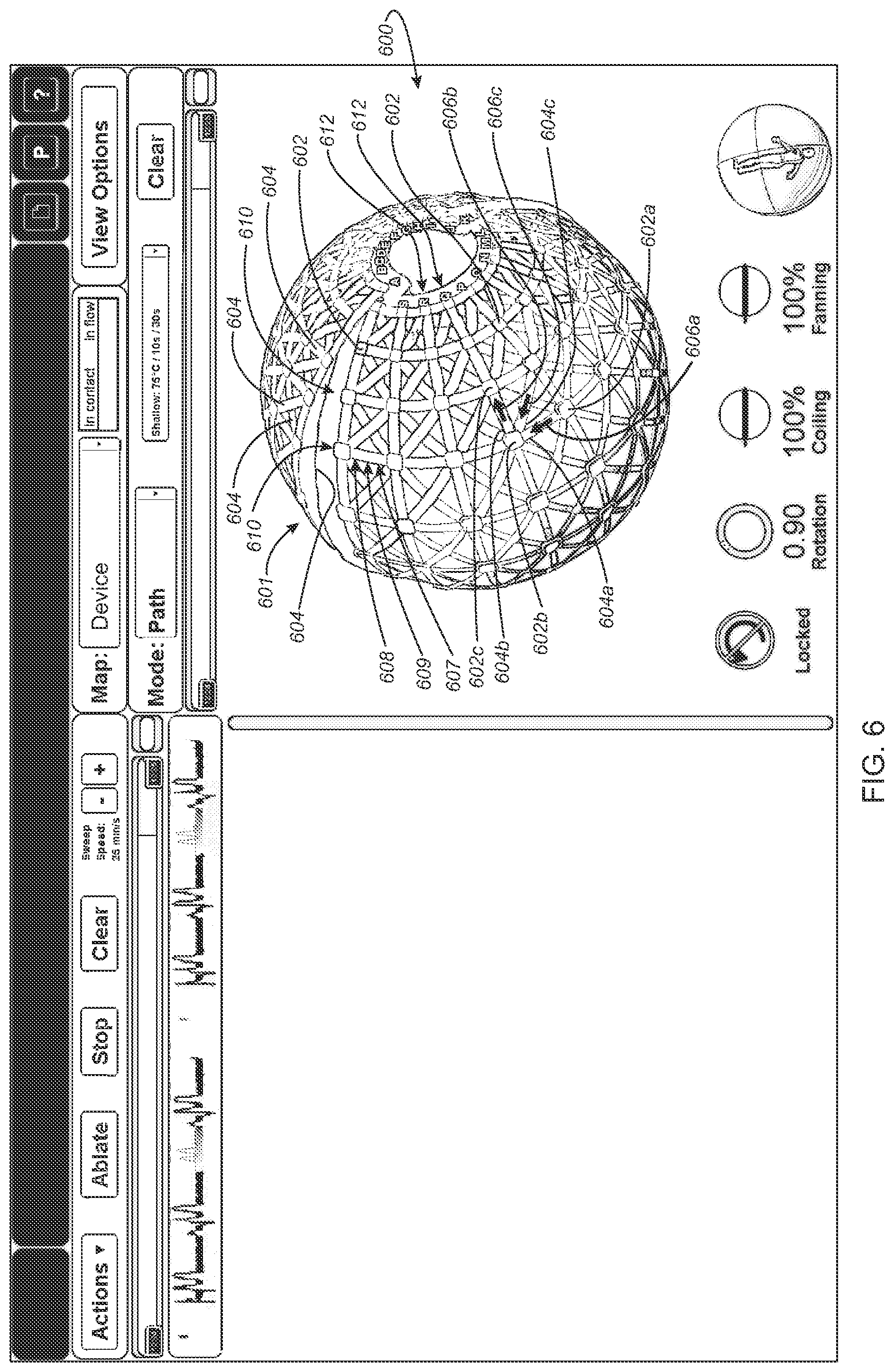 Patent US12324636 Figure 16 – Systems and methods for selecting, activating, or selecting and activating transducers