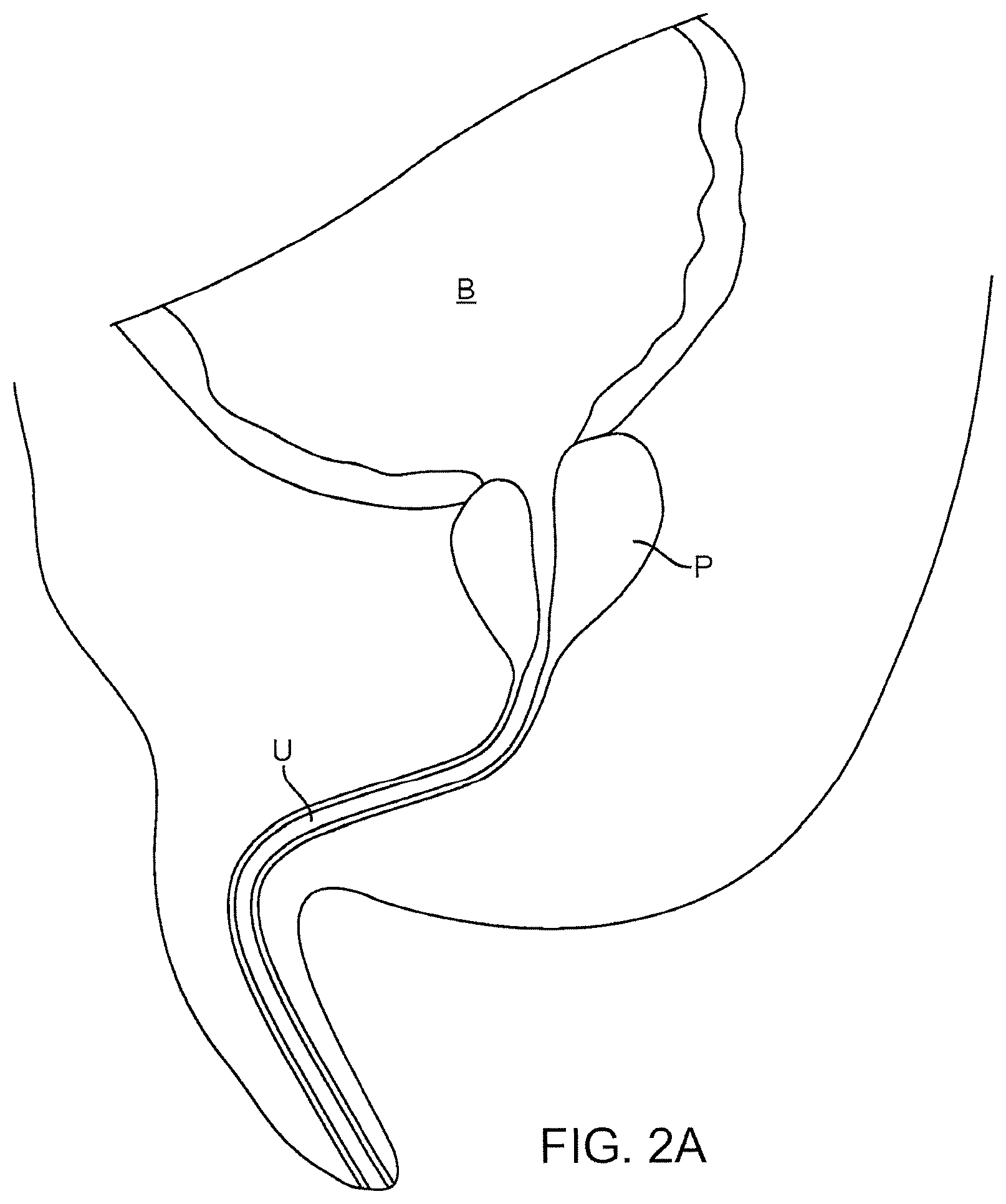 Patent US12324641 Figure 2 – Artificial intelligence for robotic surgery