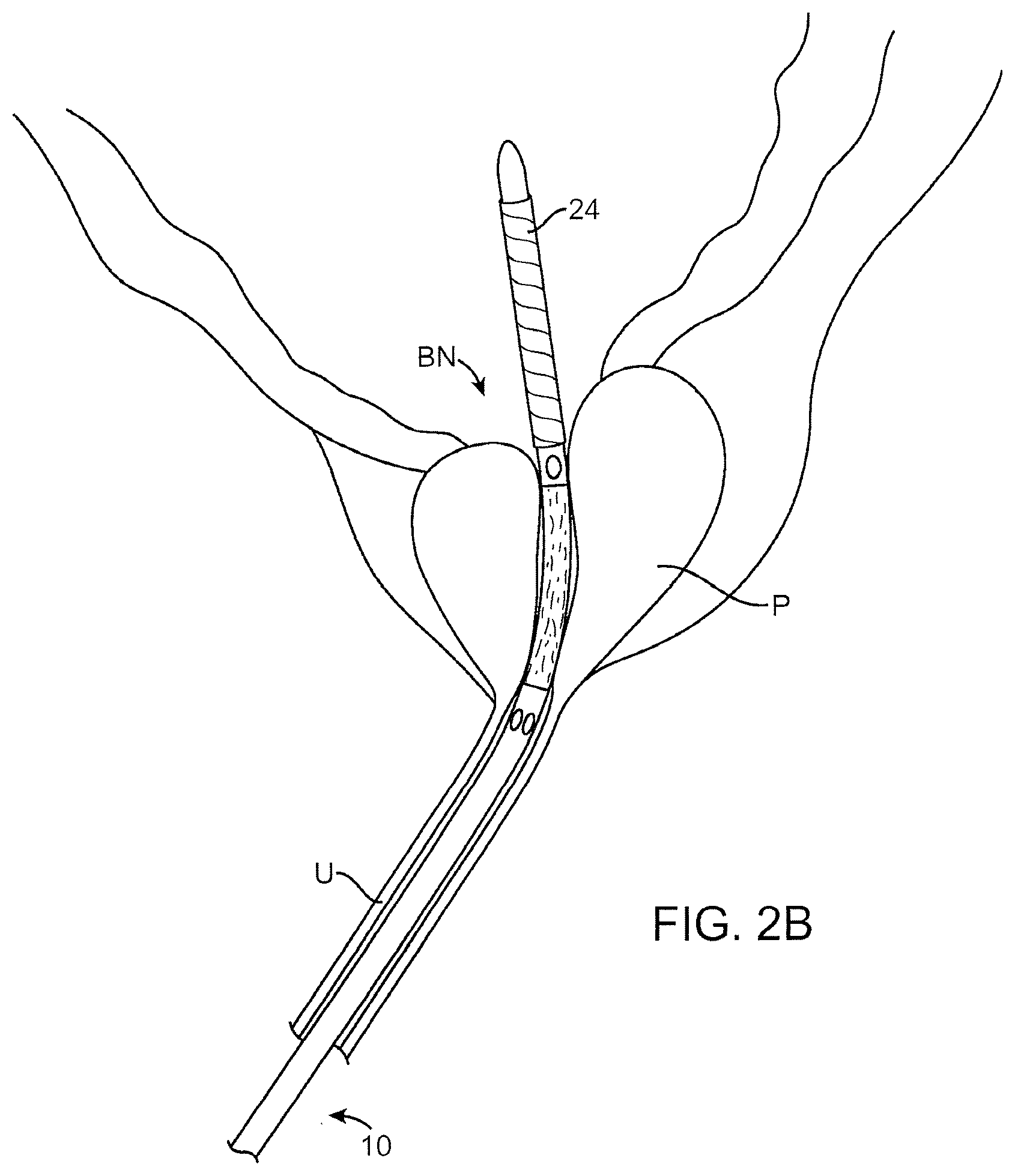Patent US12324641 Figure 3 – Artificial intelligence for robotic surgery