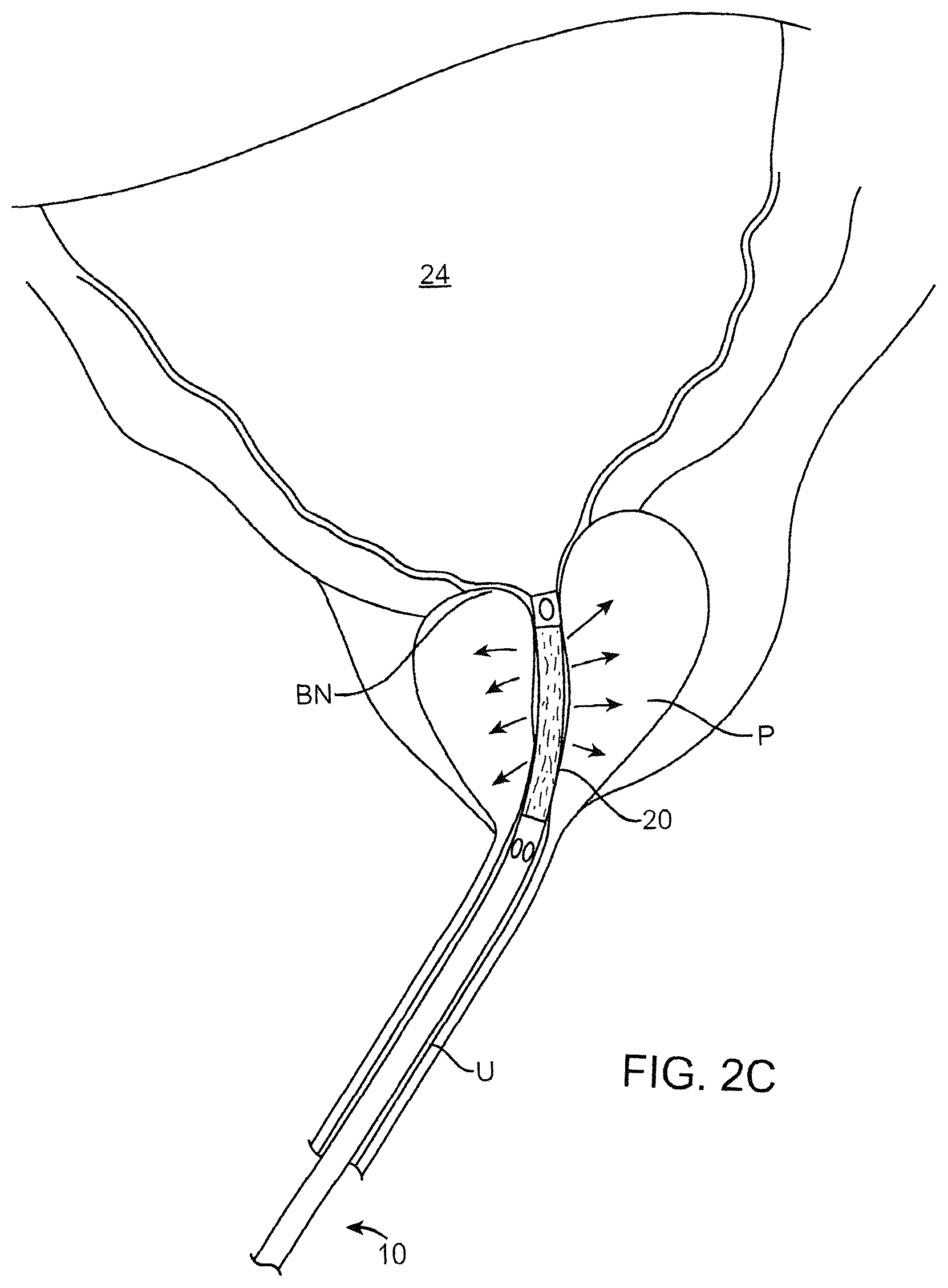 Patent US12324641 Figure 4 – Artificial intelligence for robotic surgery