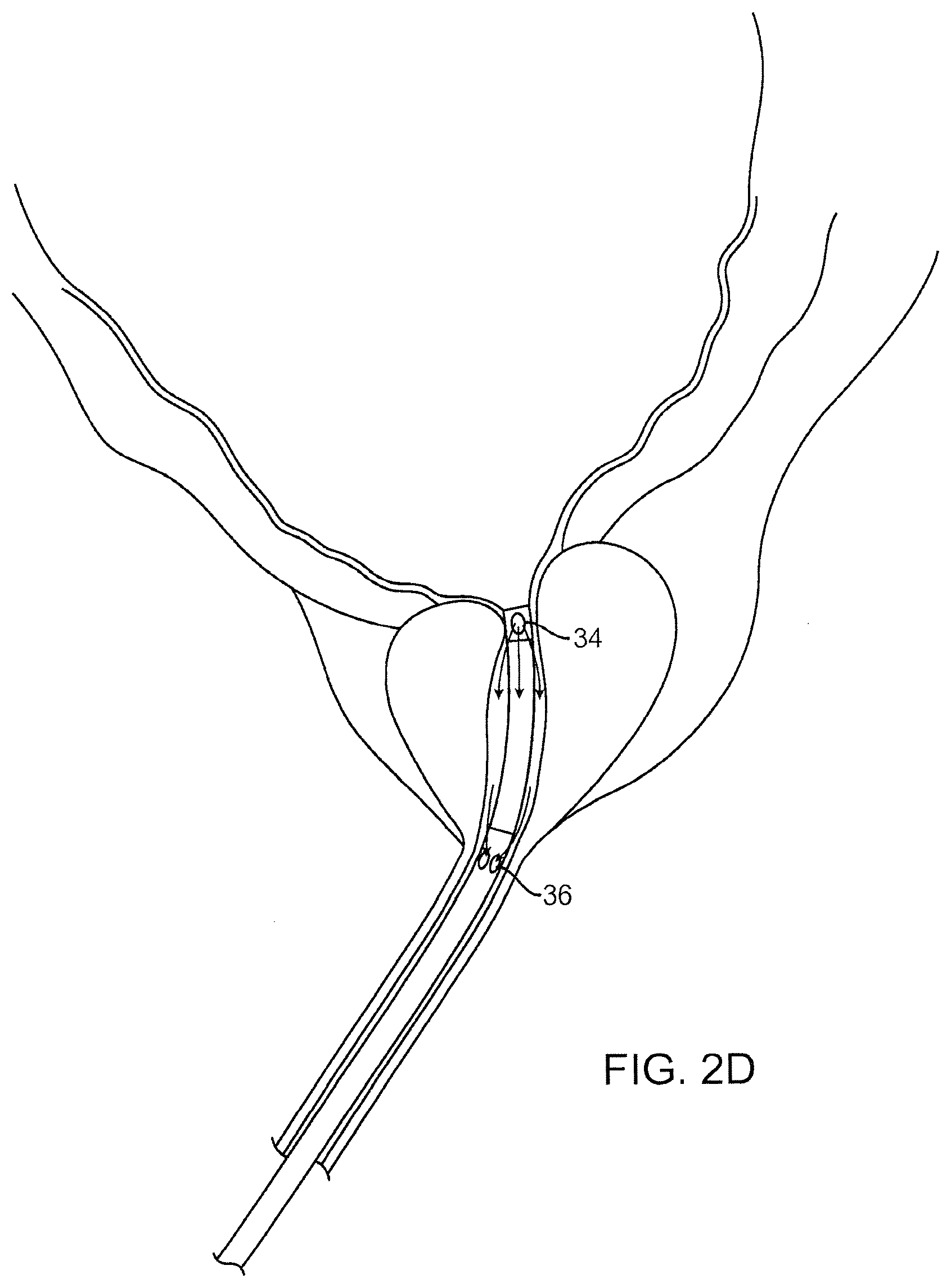 Patent US12324641 Figure 5 – Artificial intelligence for robotic surgery