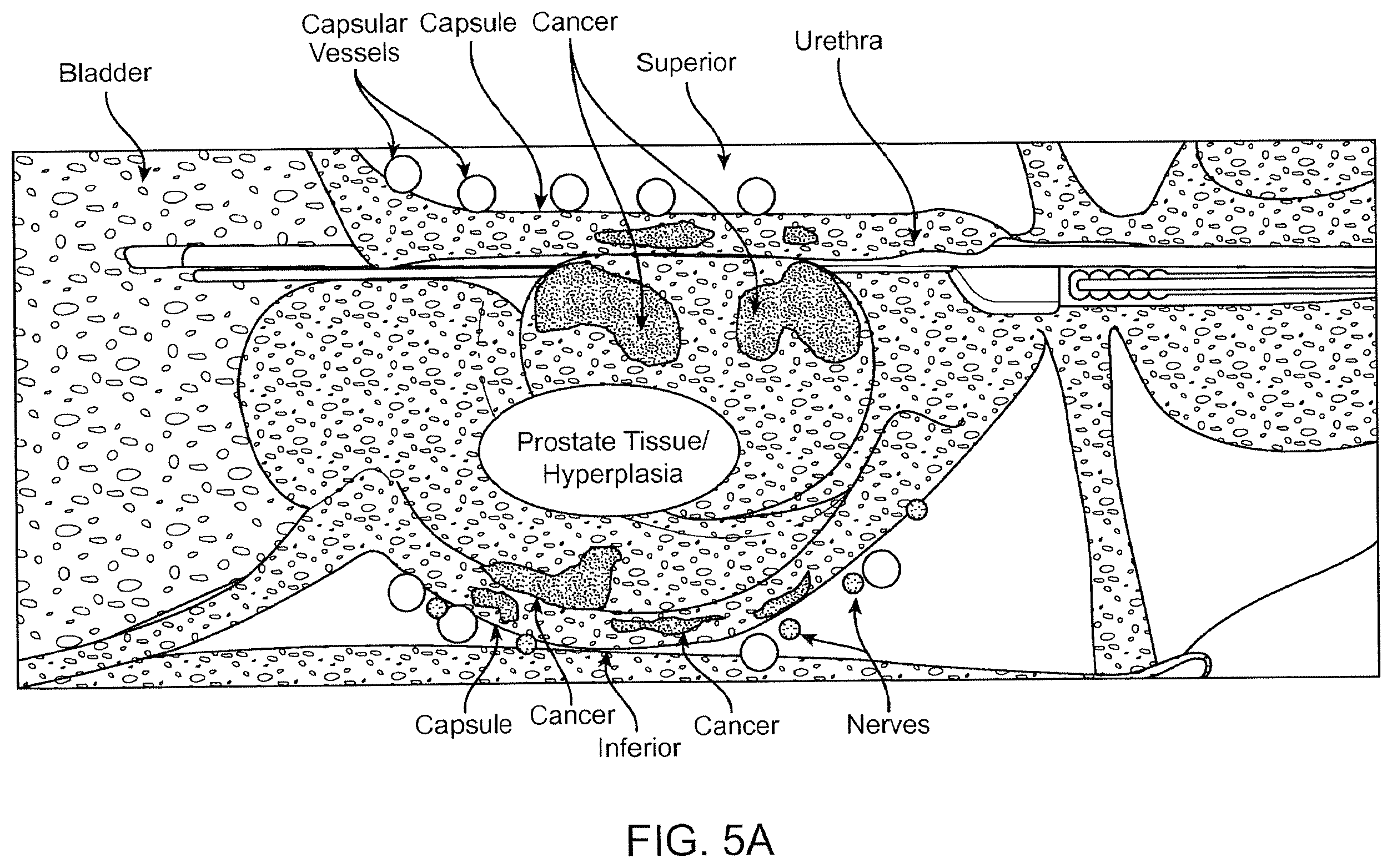 Patent US12324641 Figure 9 – Artificial intelligence for robotic surgery