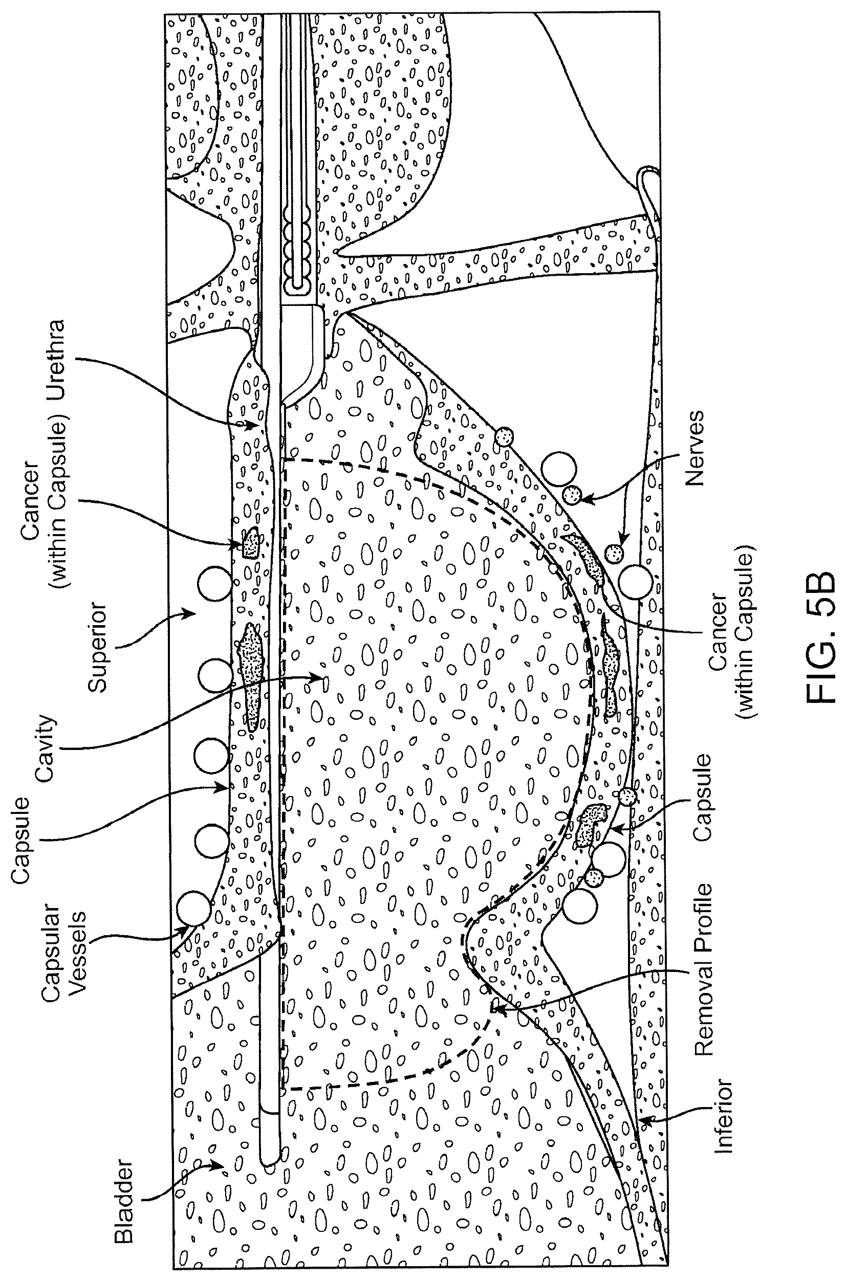 Patent US12324641 Figure 10 – Artificial intelligence for robotic surgery