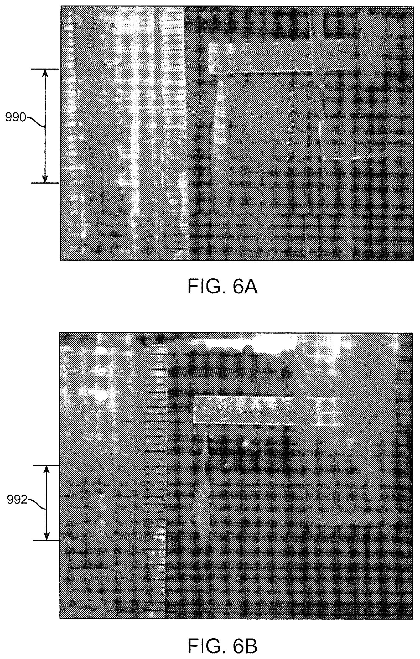 Patent US12324641 Figure 11 – Artificial intelligence for robotic surgery