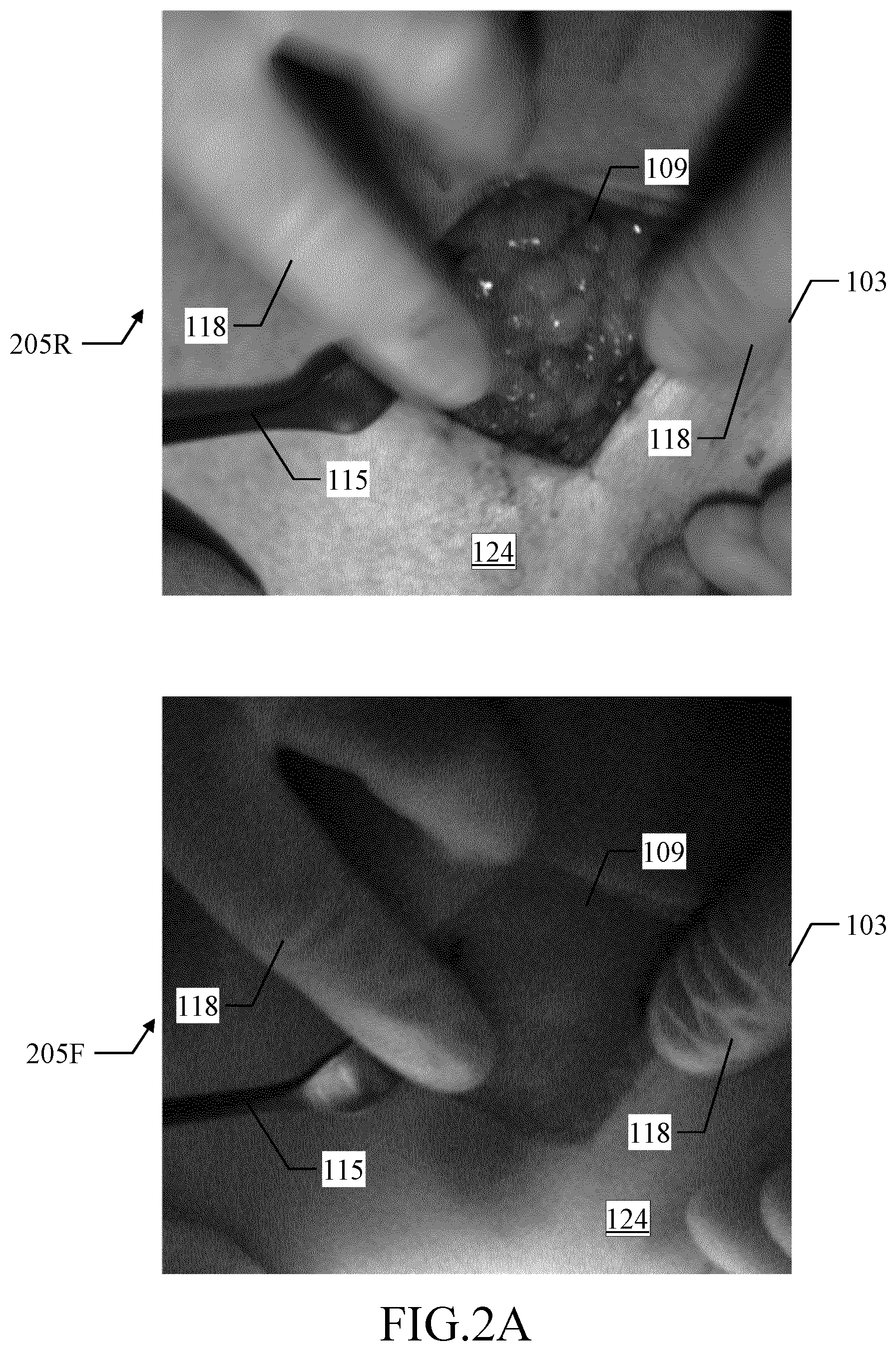 Patent US12324648 Figure 2 – Assisting medical procedures with luminescence images processed in limited informative regions identified in corresponding auxiliary images