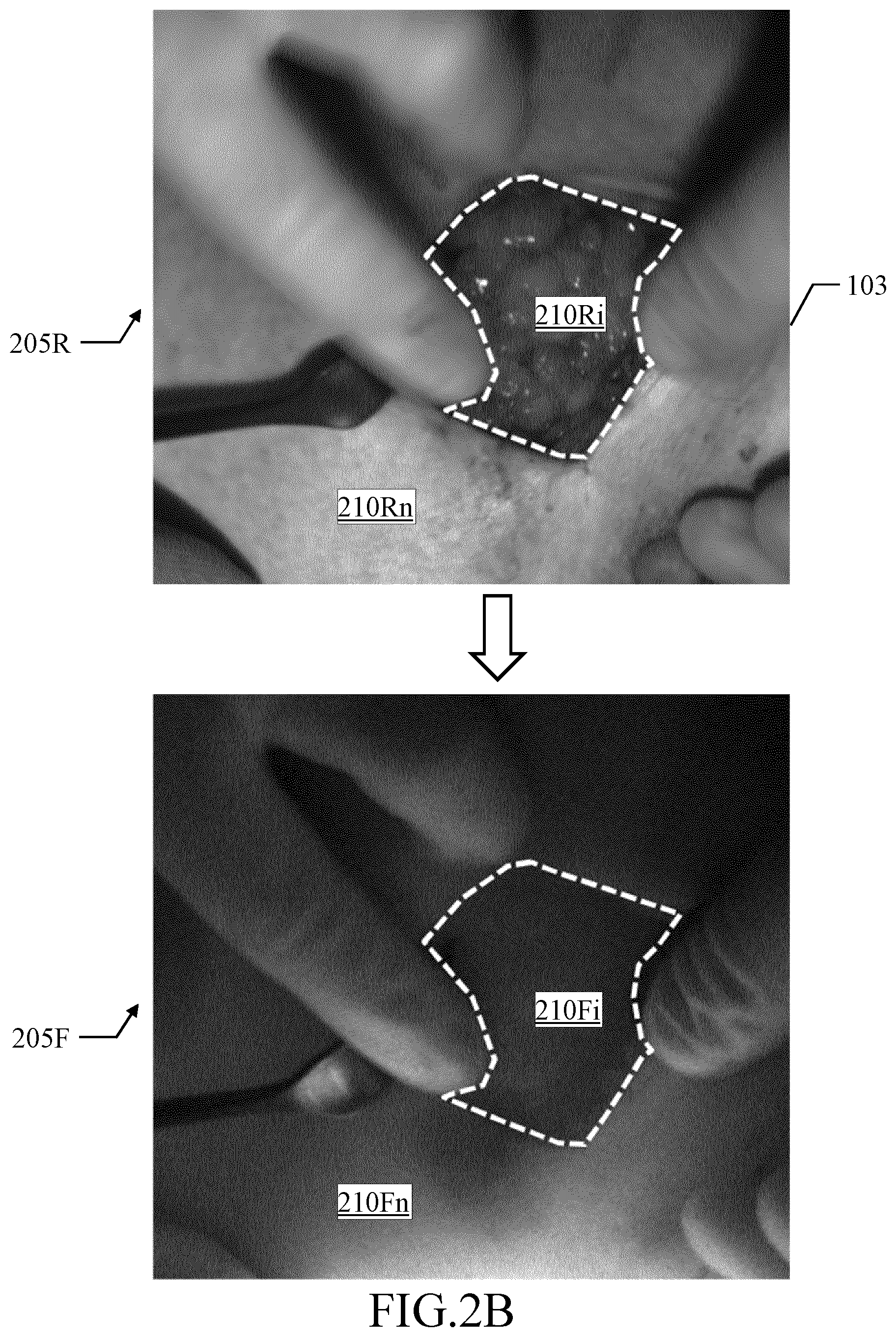 Patent US12324648 Figure 3 – Assisting medical procedures with luminescence images processed in limited informative regions identified in corresponding auxiliary images